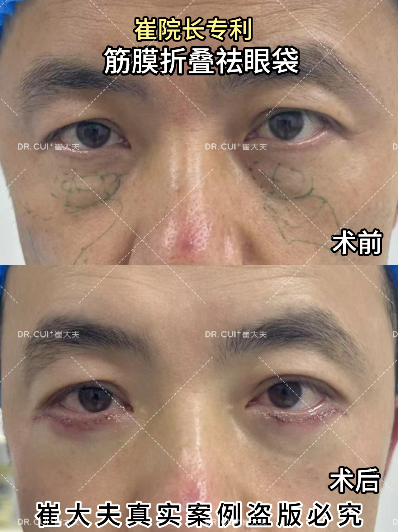 对比 (35)