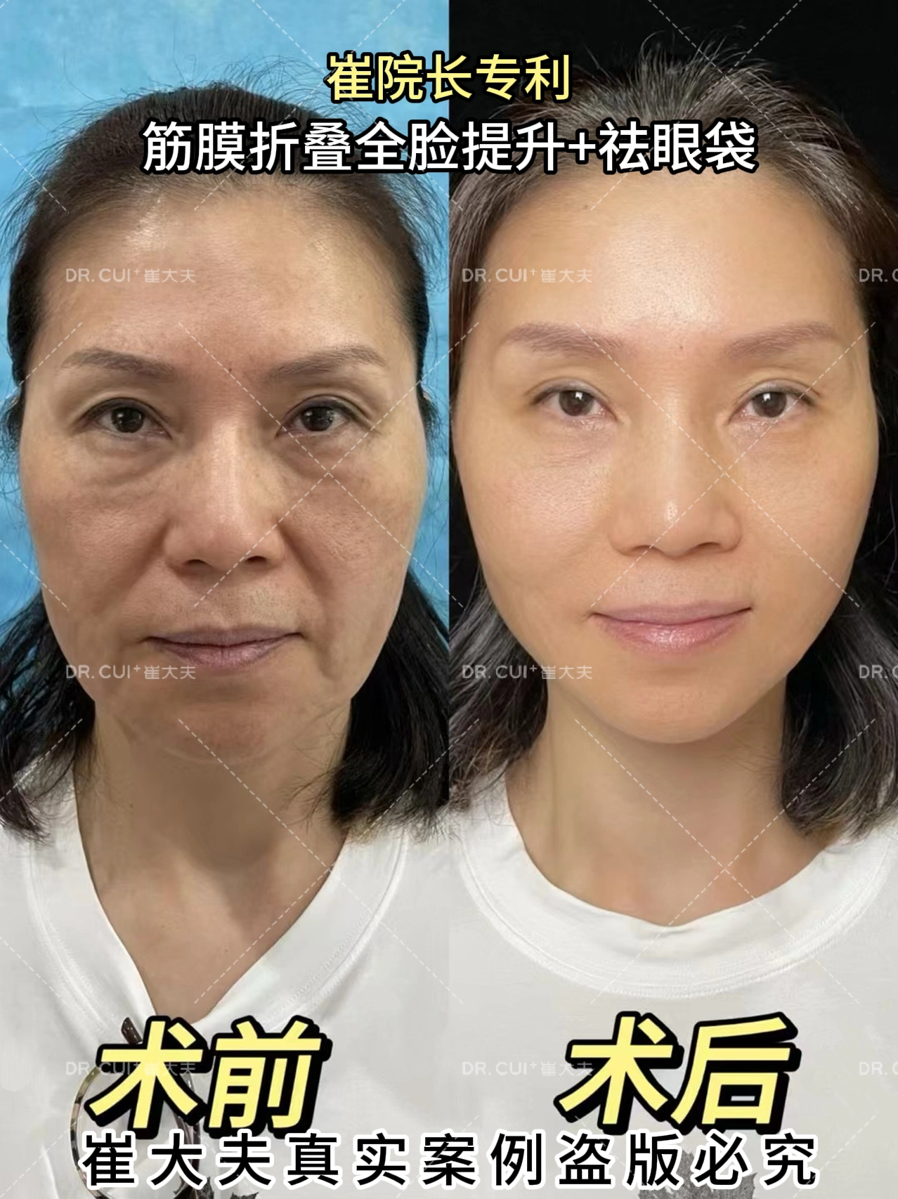 对比 (37)