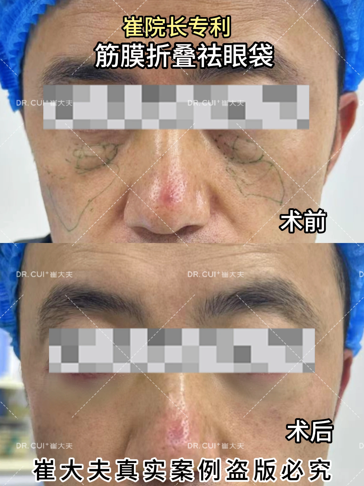 对比 (38)