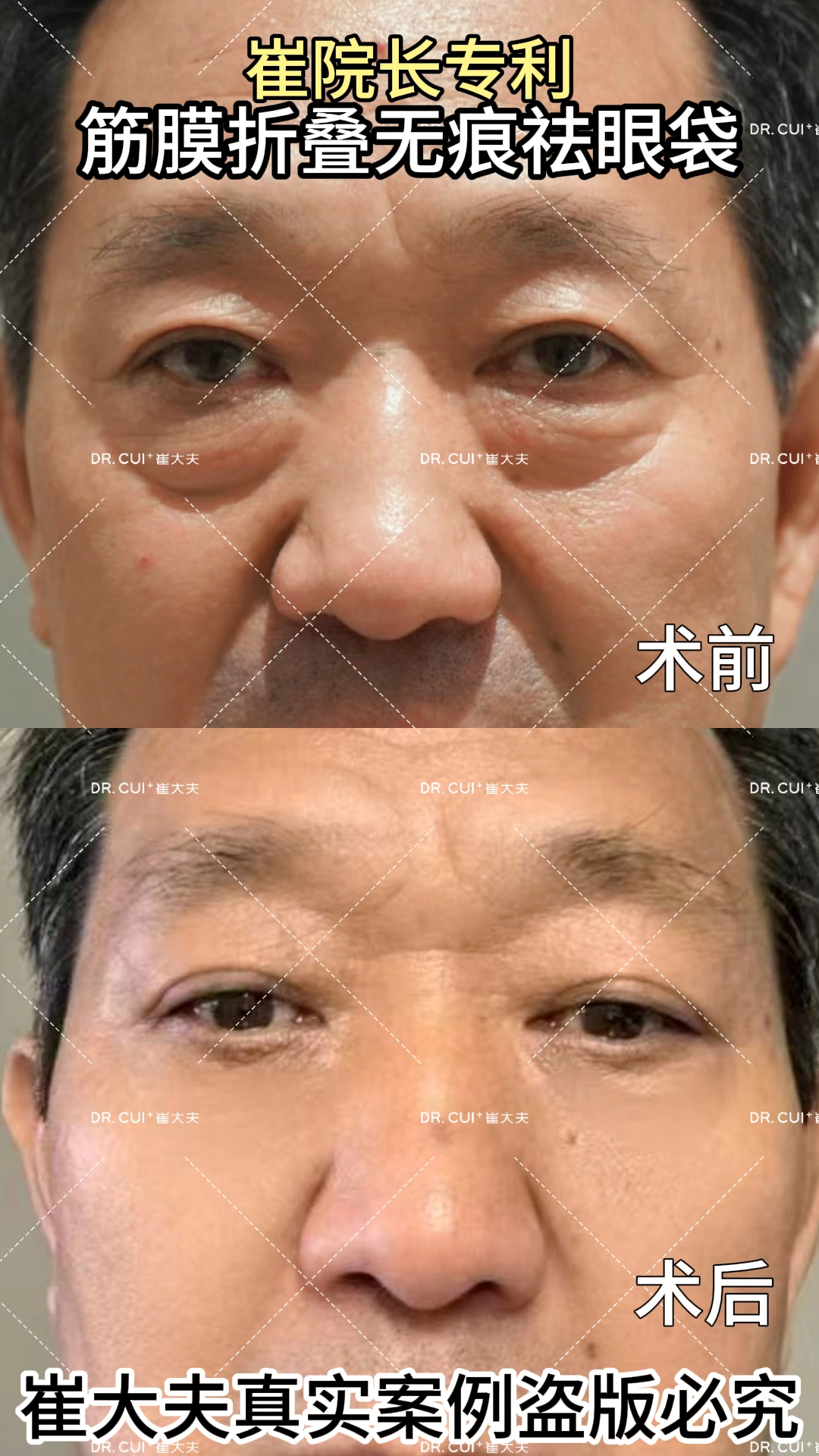 对比 (39)