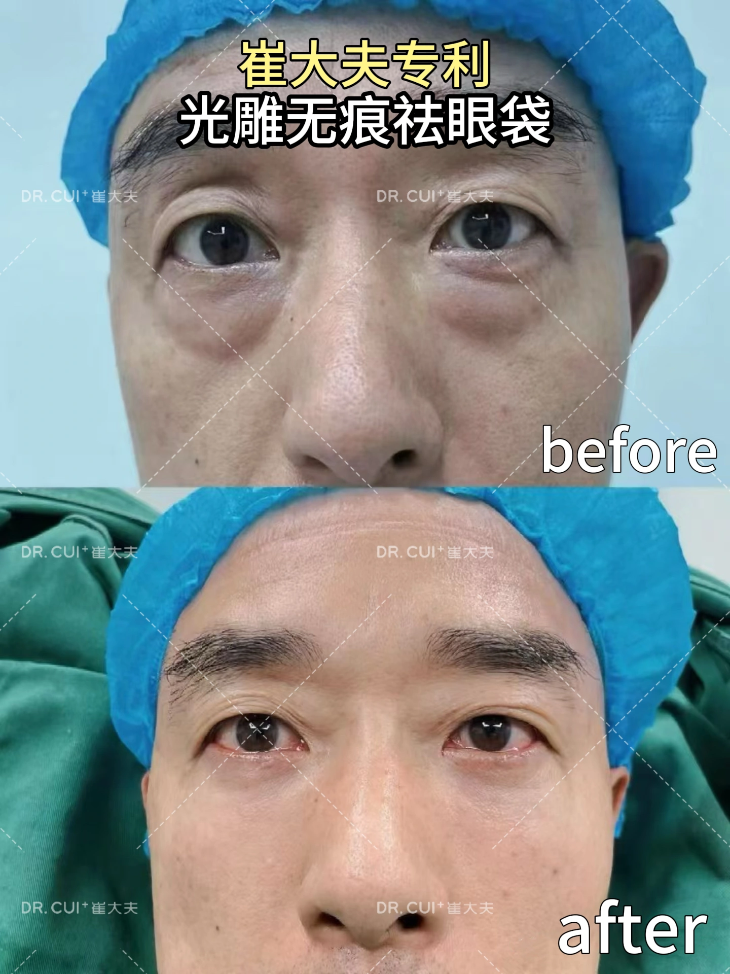 对比 (40)