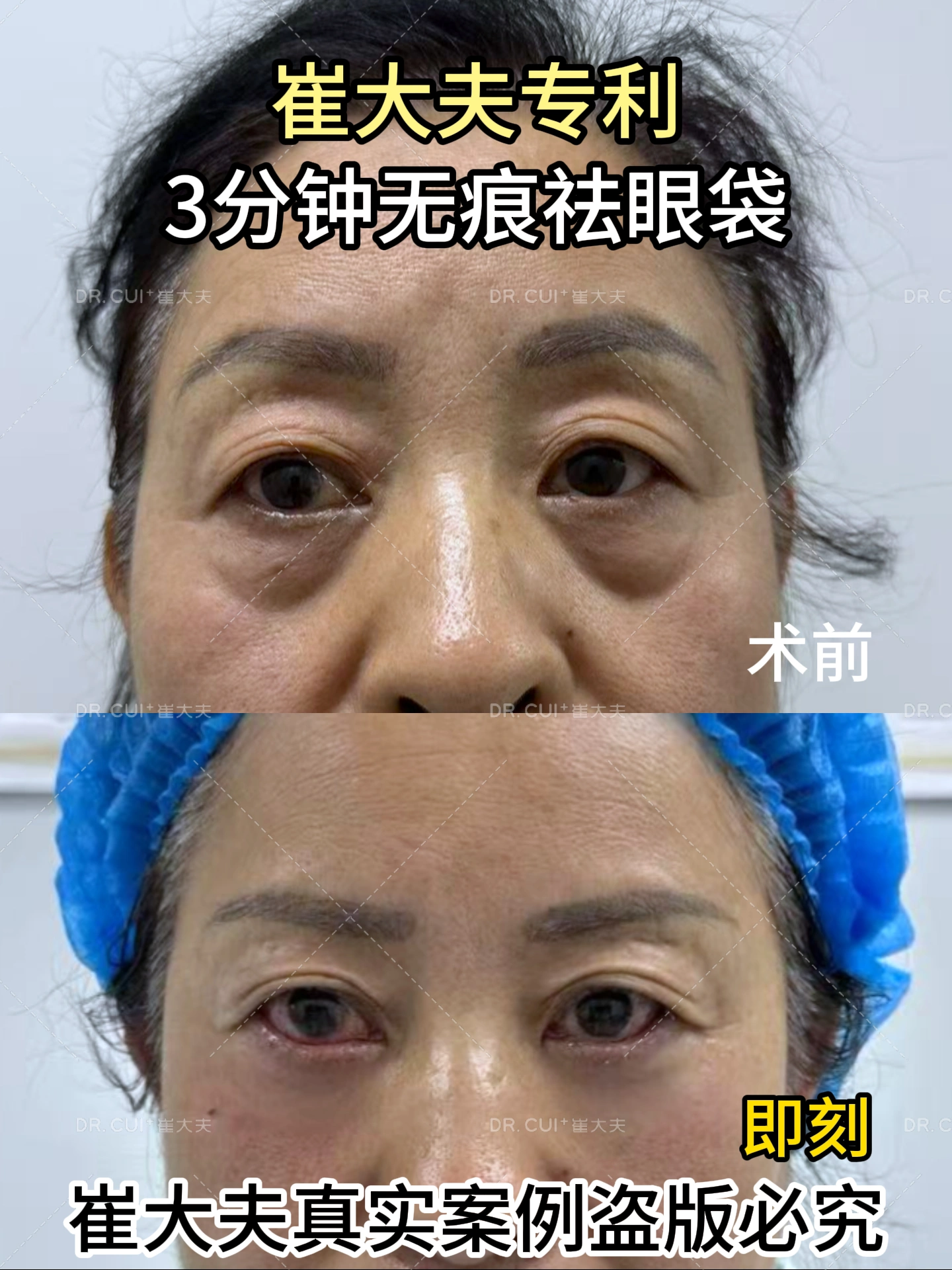 对比 (42)