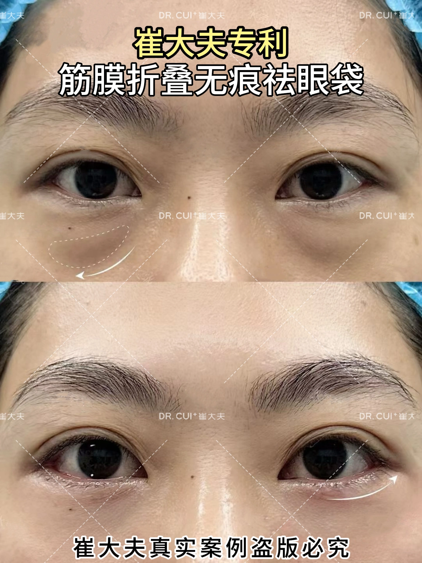 对比 (41)