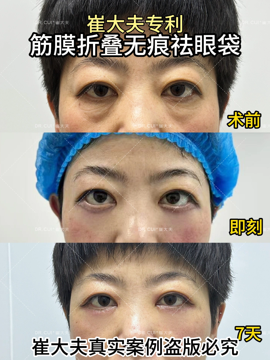 对比 (43)