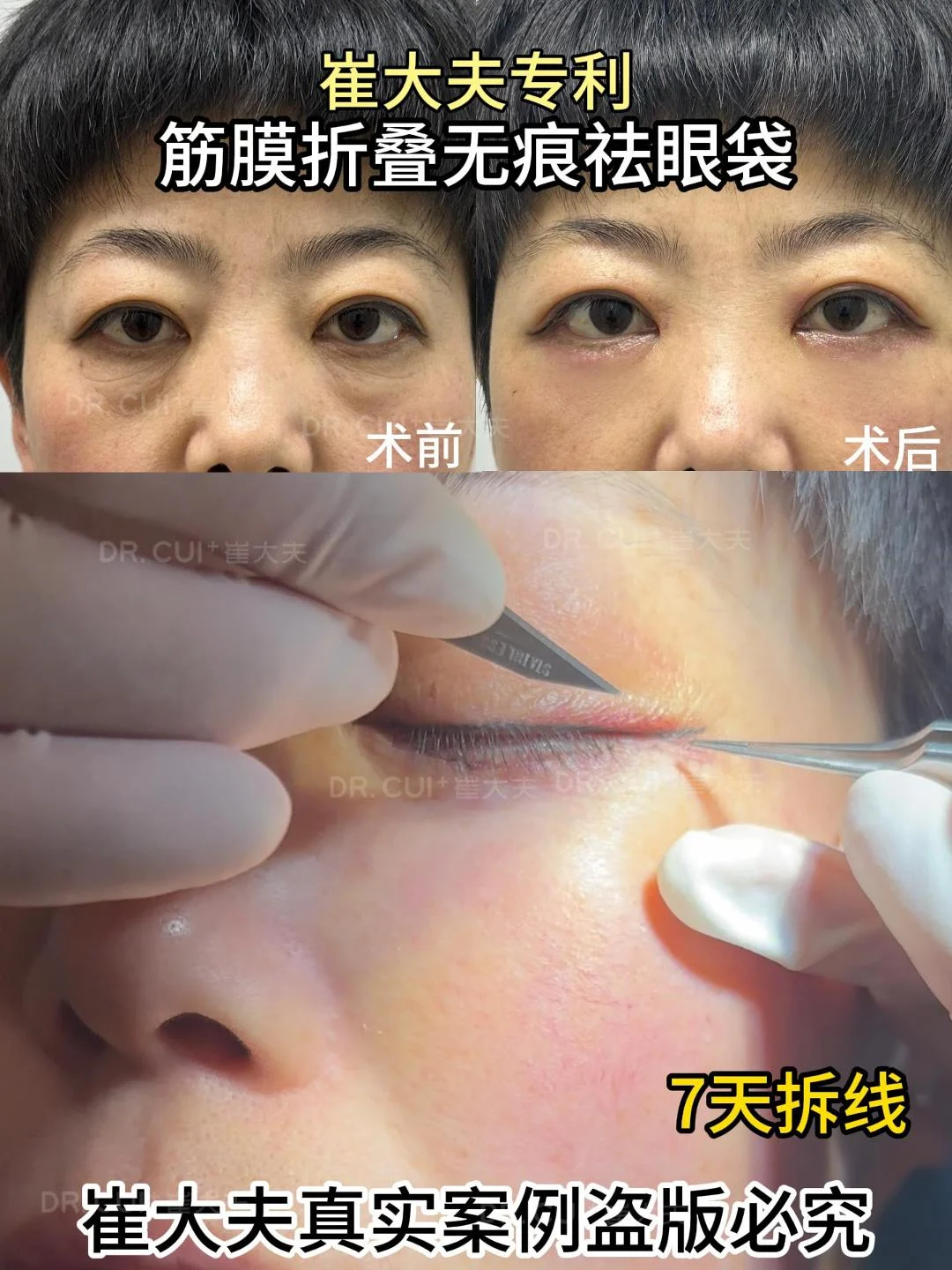 对比 (44)