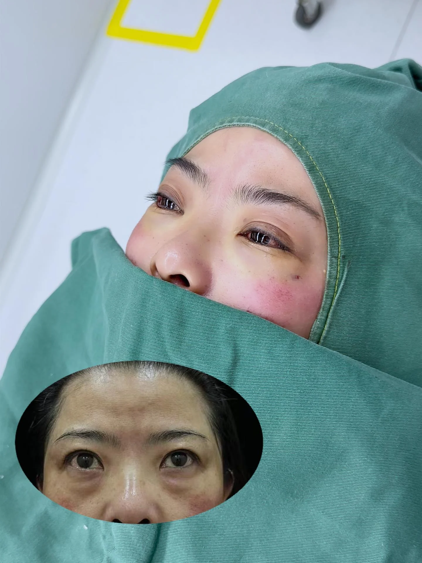 对比 (45)