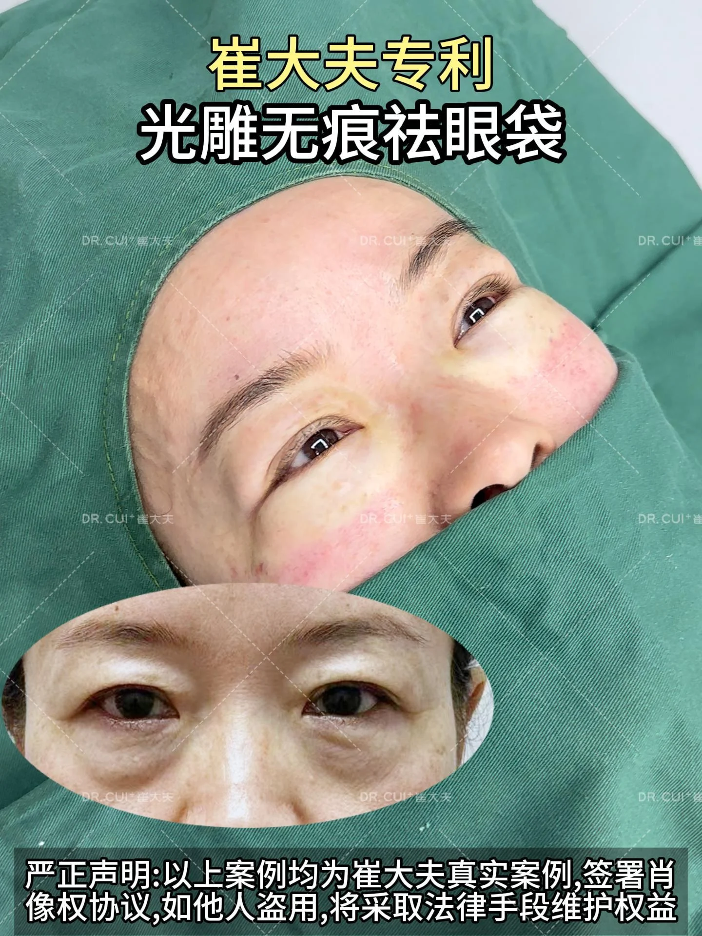 对比 (47)