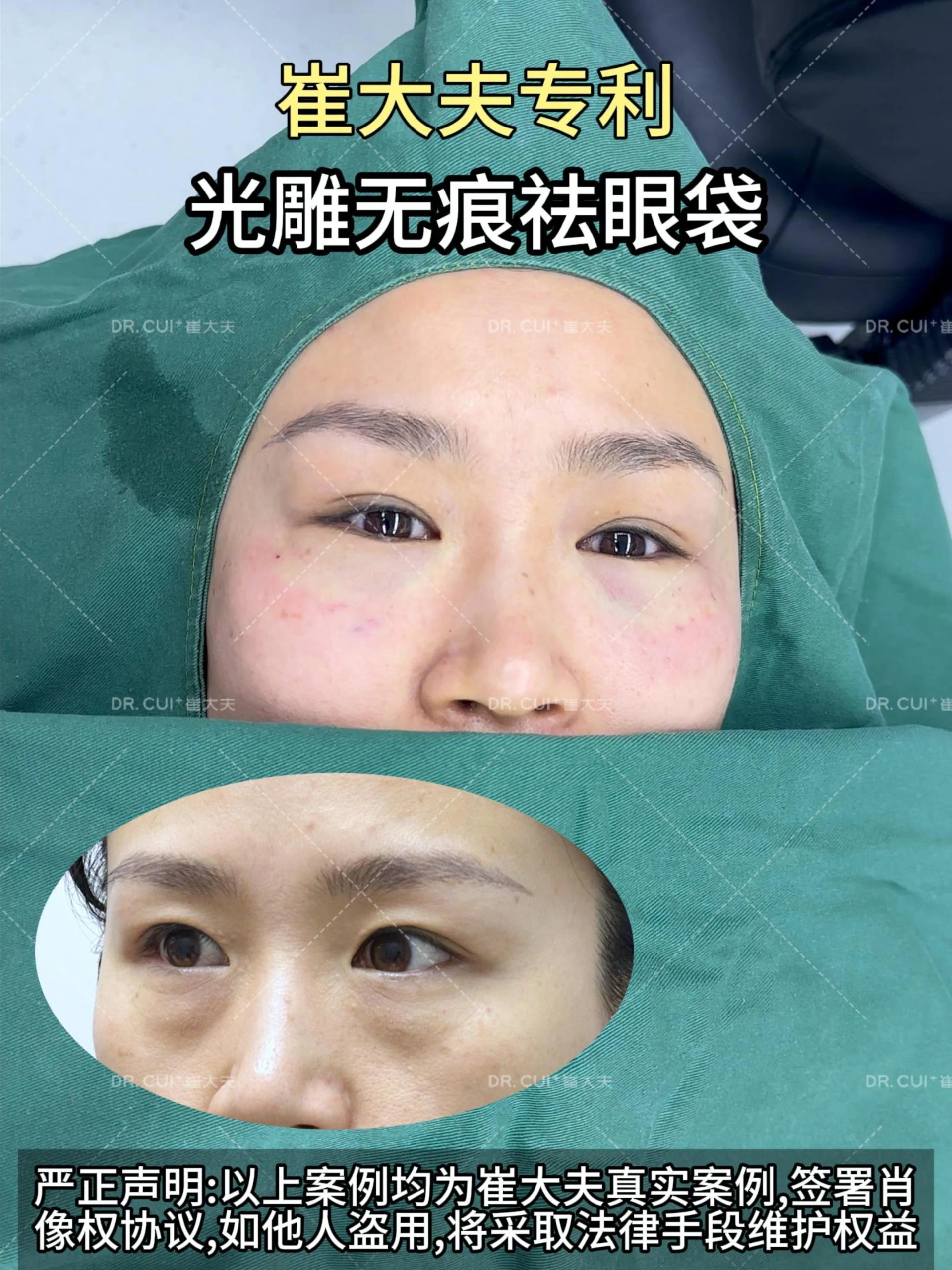 对比 (48)