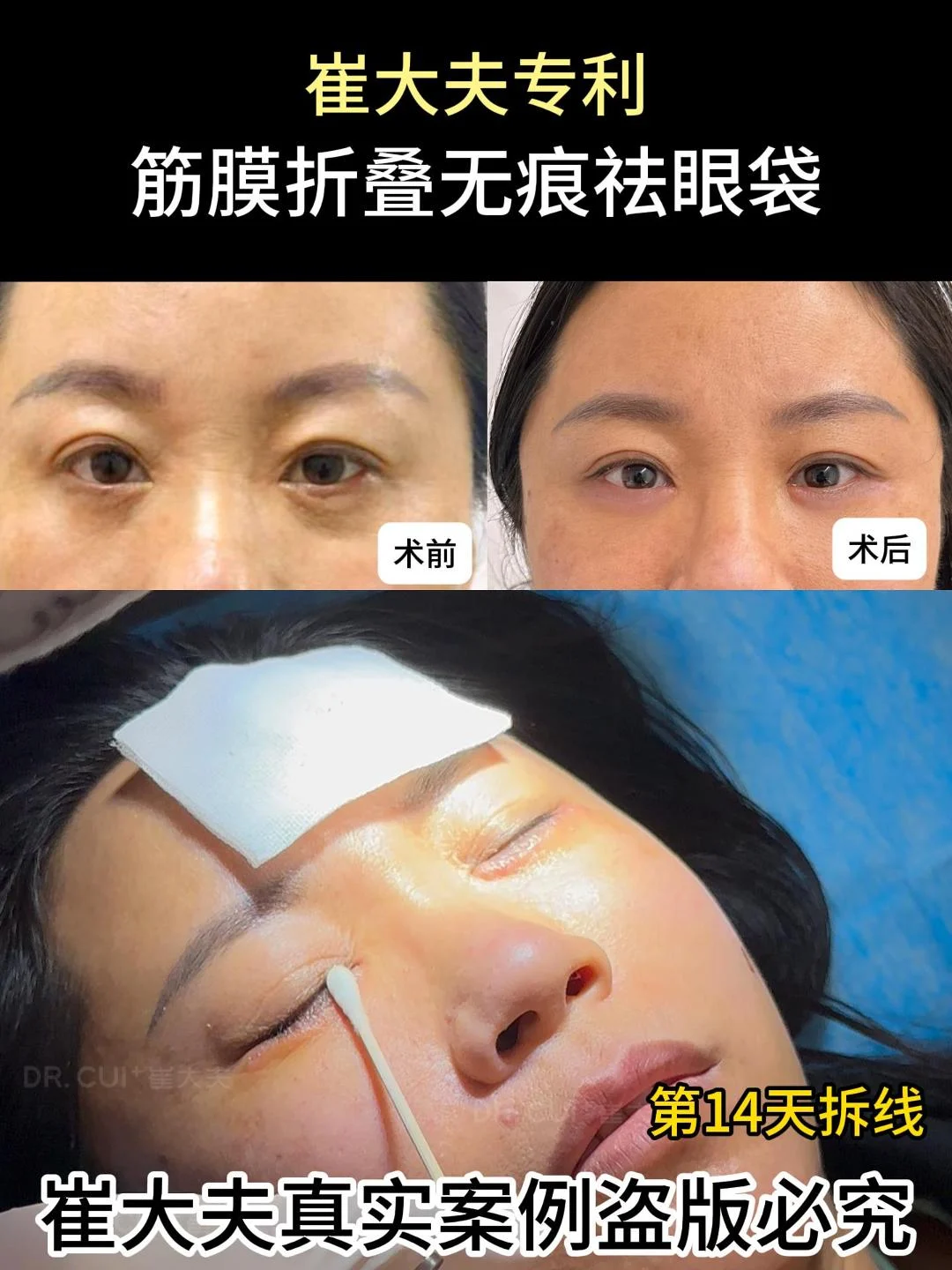 对比 (49)