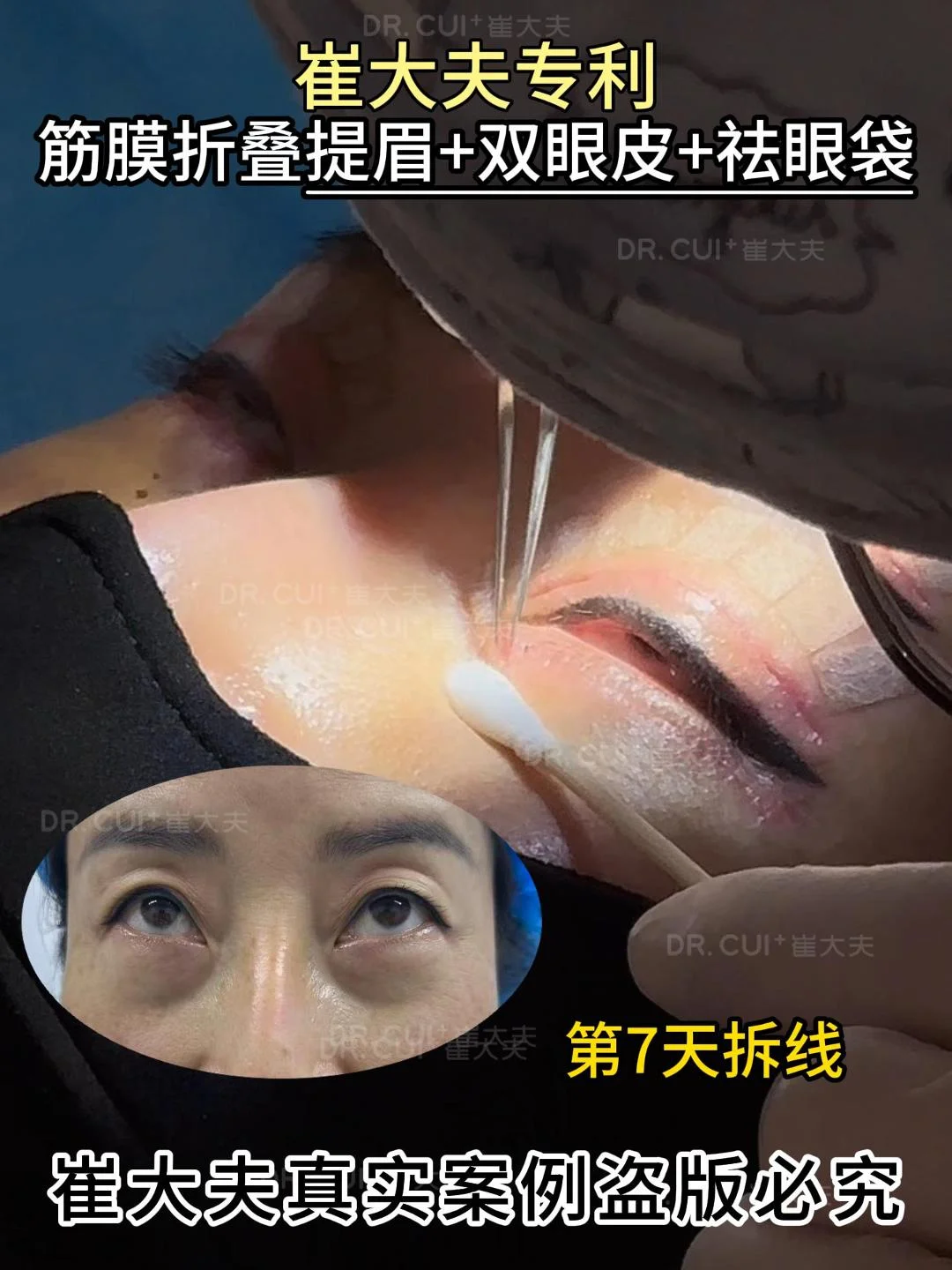 对比 (51)