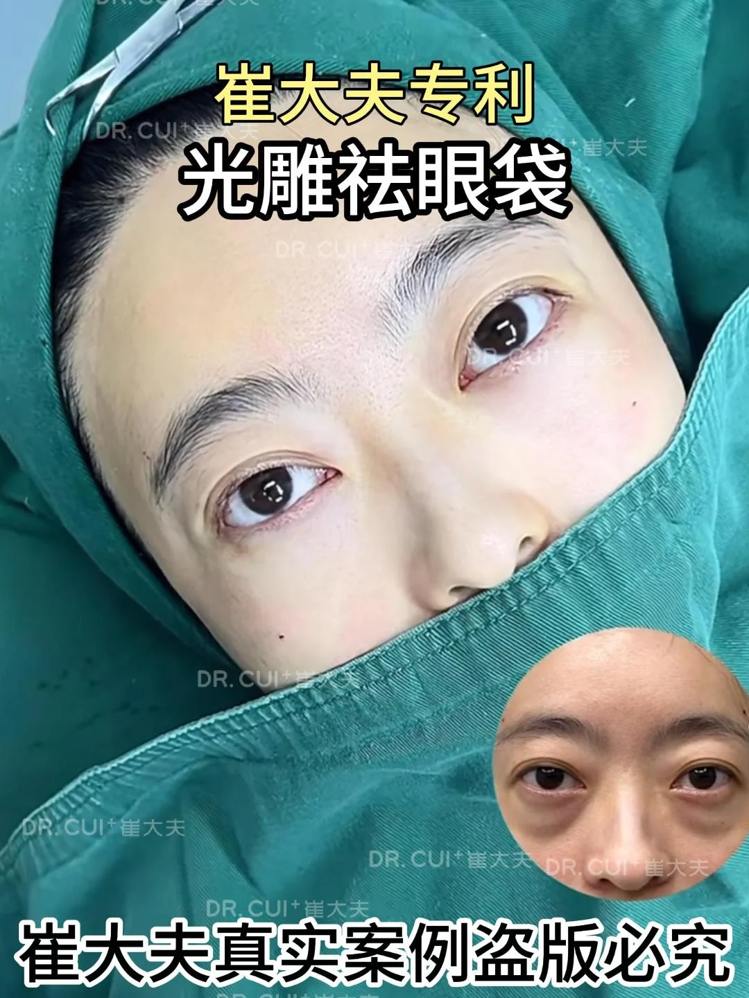 对比 (52)