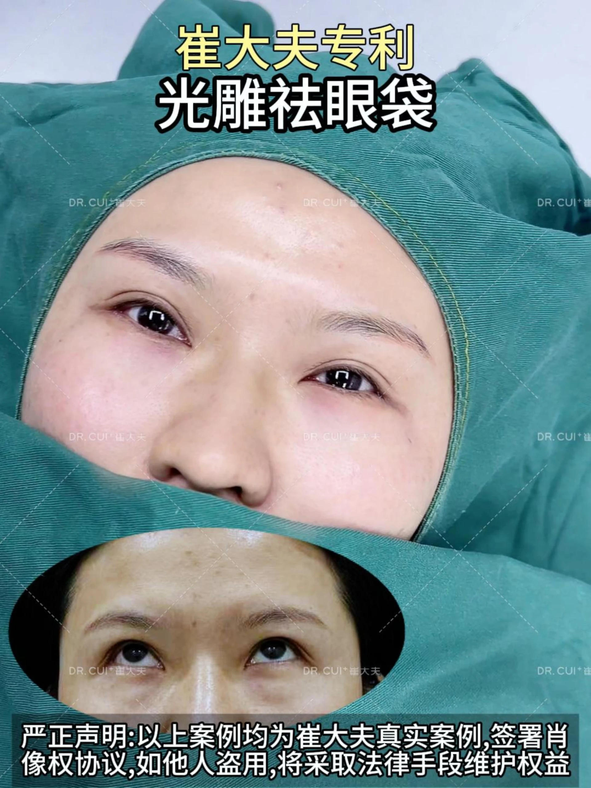 对比 (55)