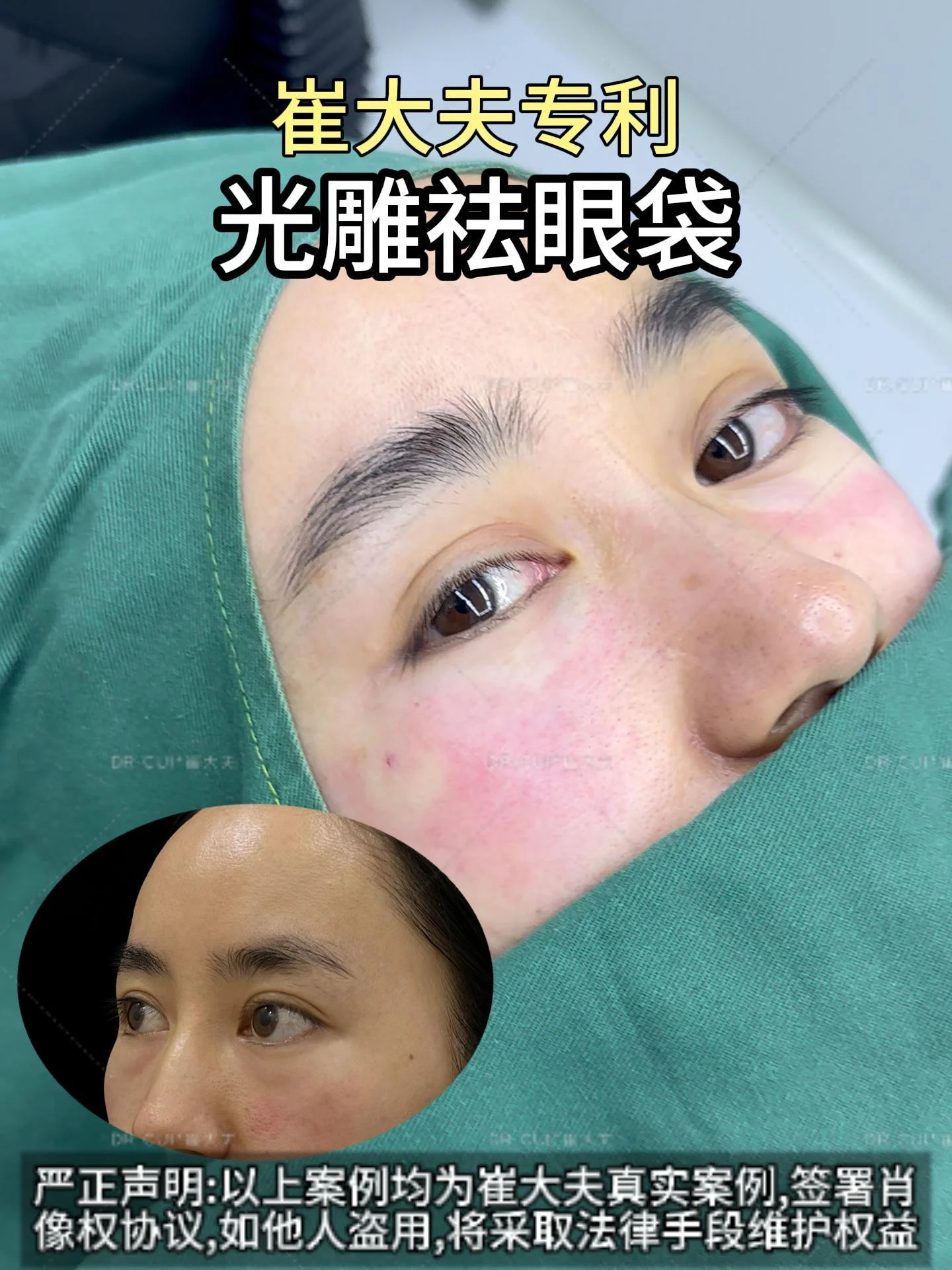 对比 (56)