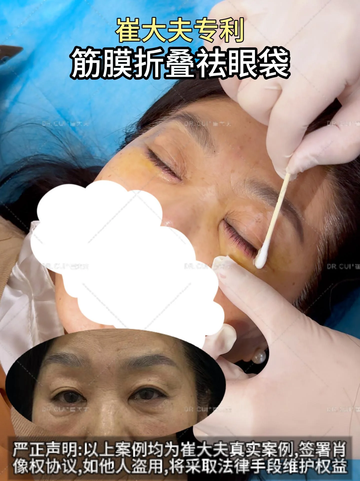 对比 (57)