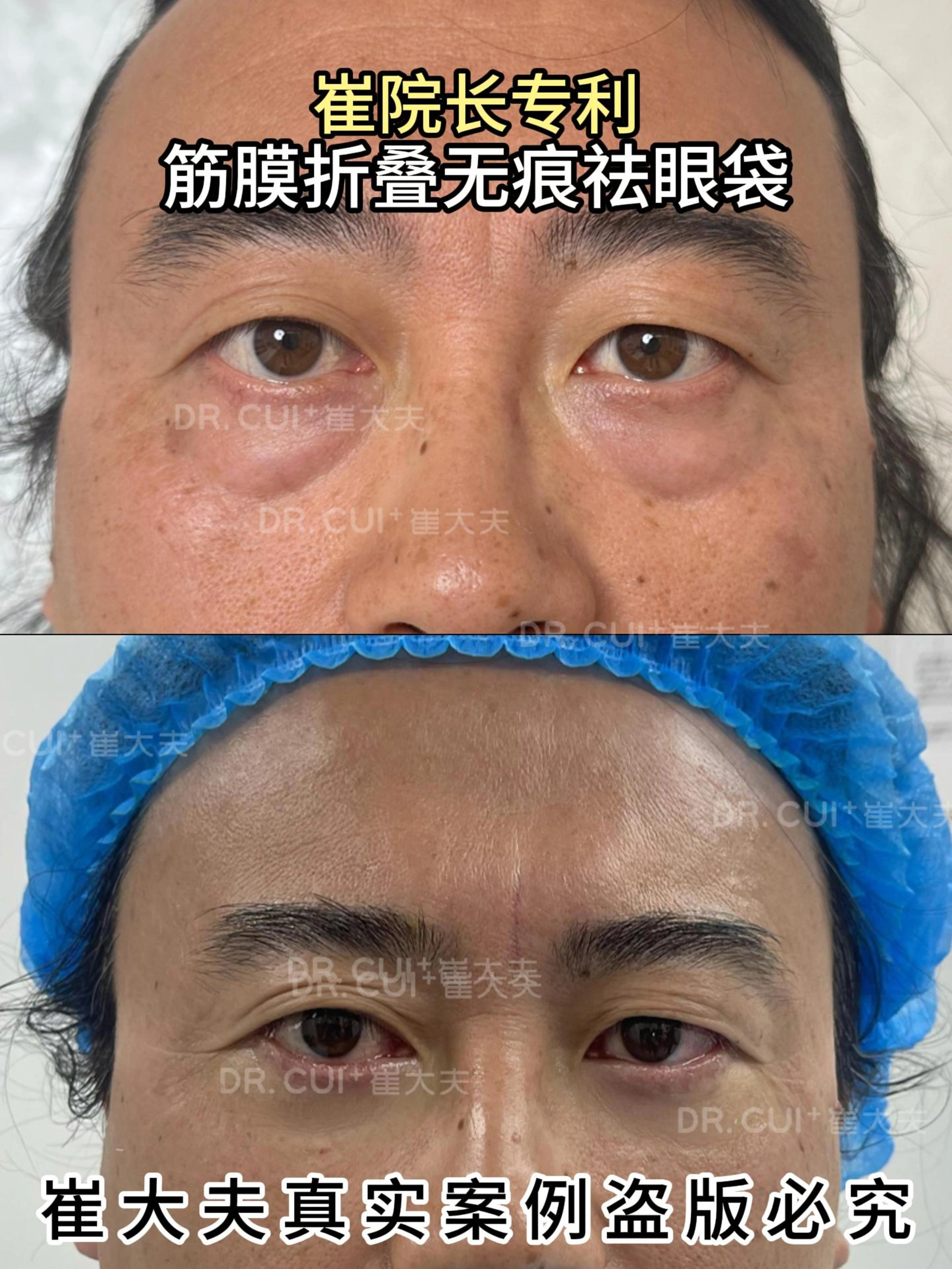 对比 (59)