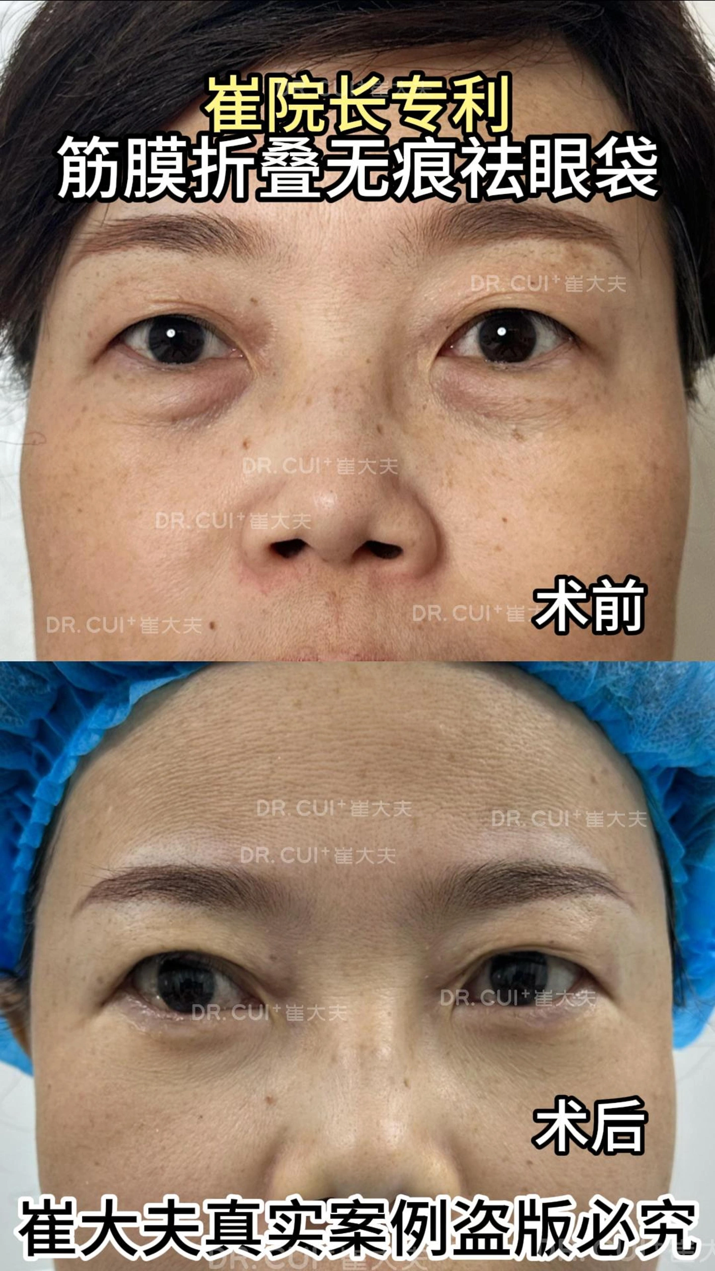 对比 (60)