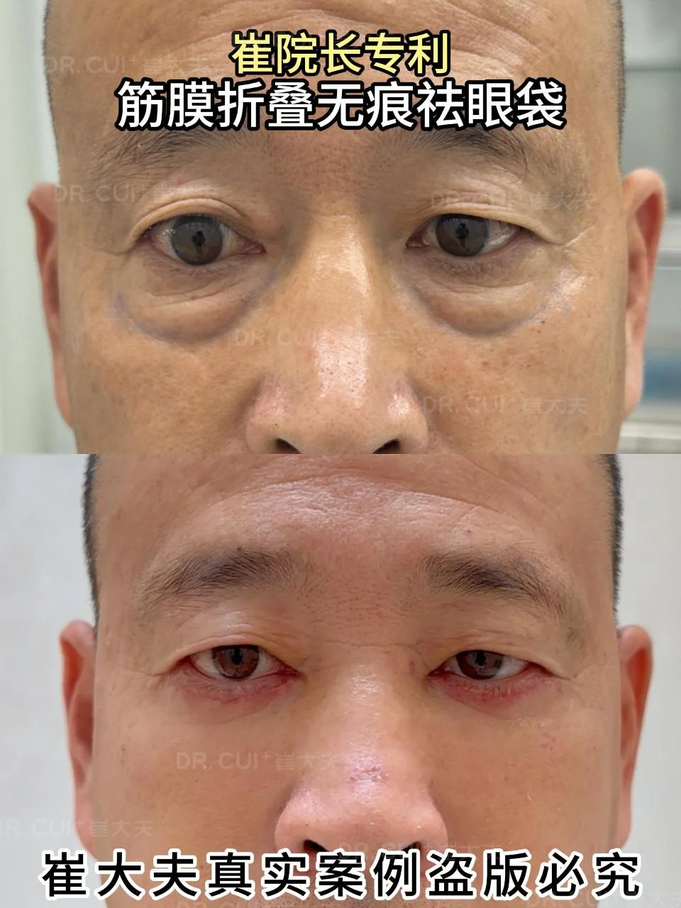 对比 (61)