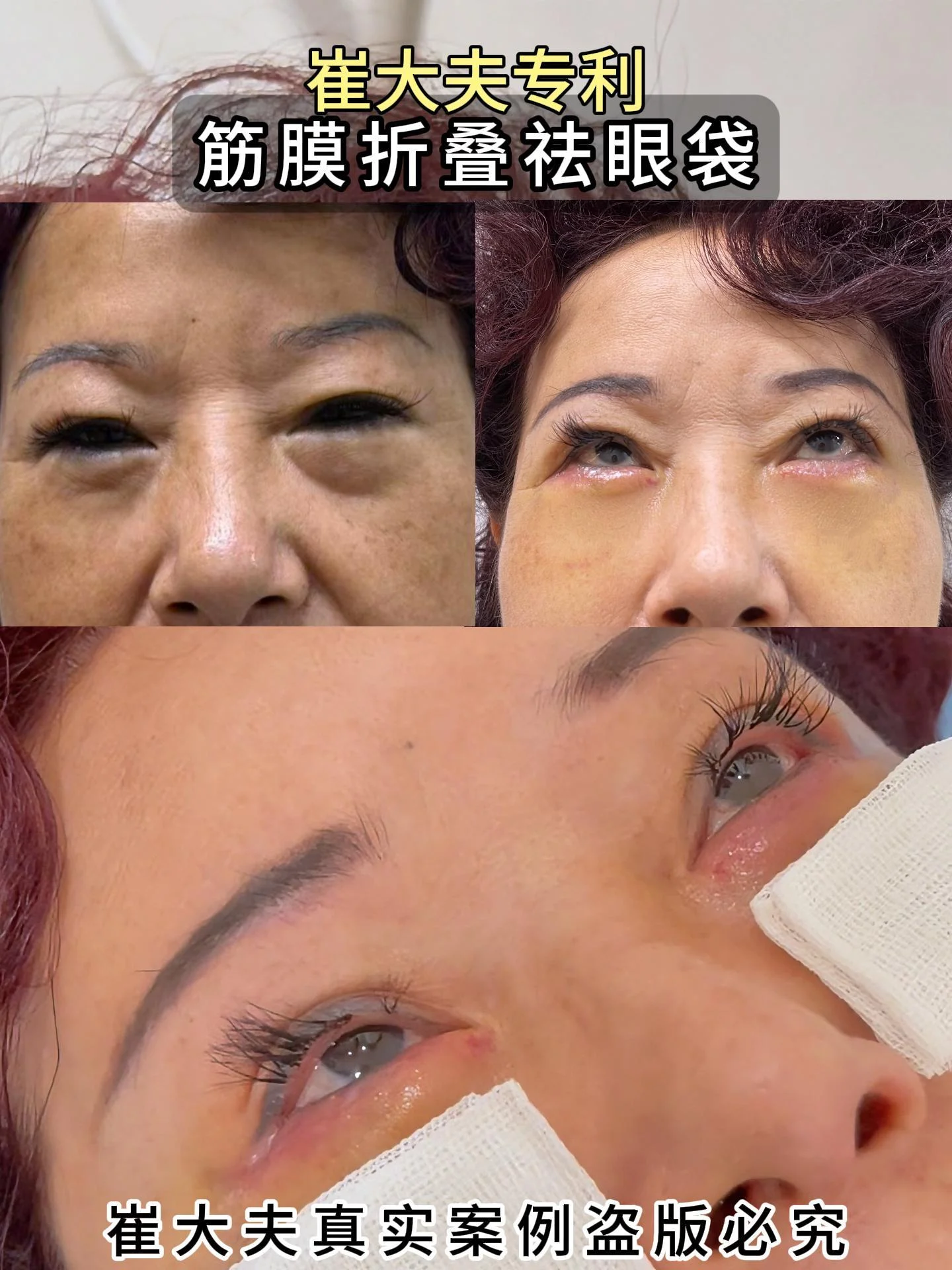对比 (63)