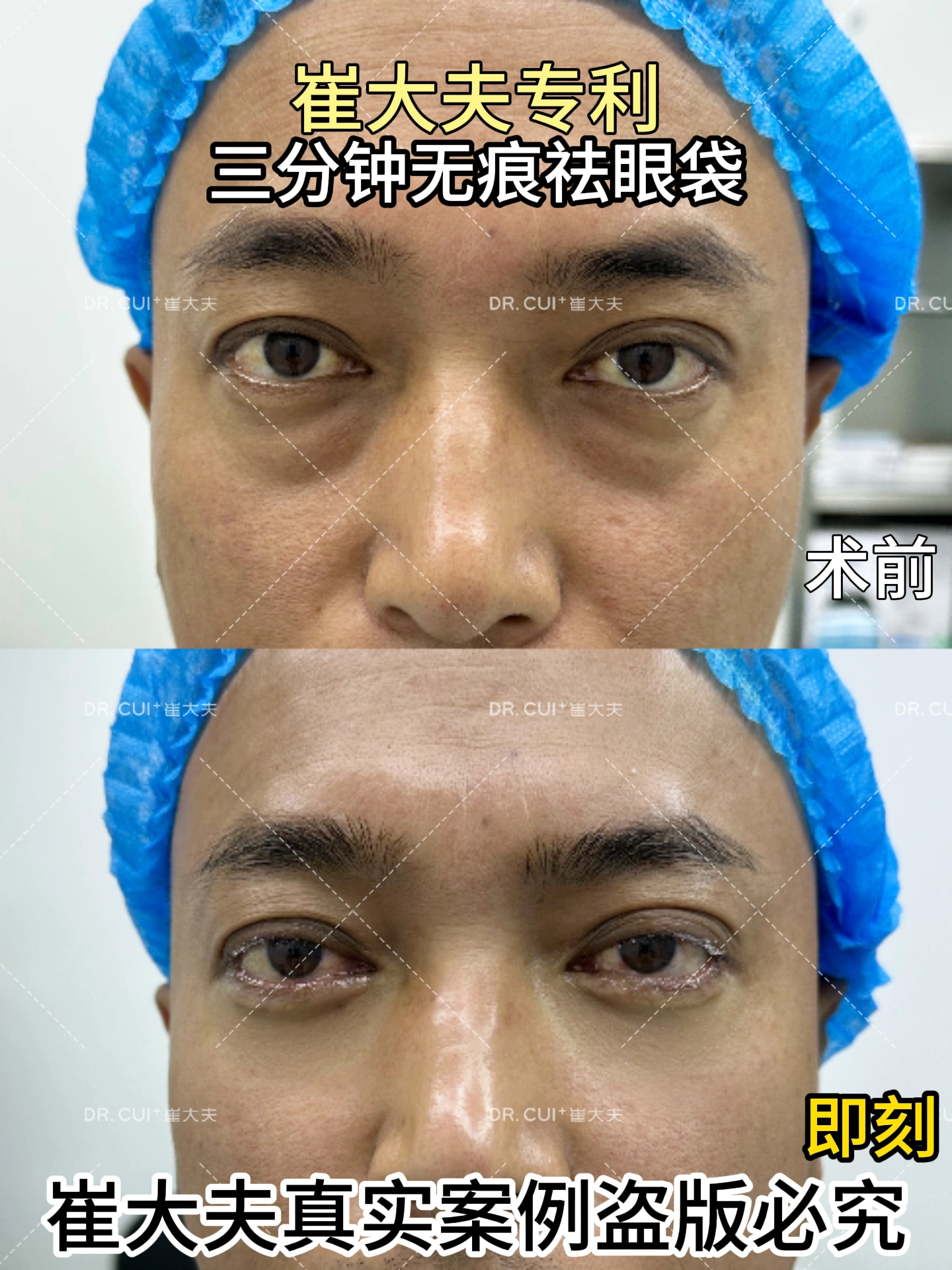对比 (65)