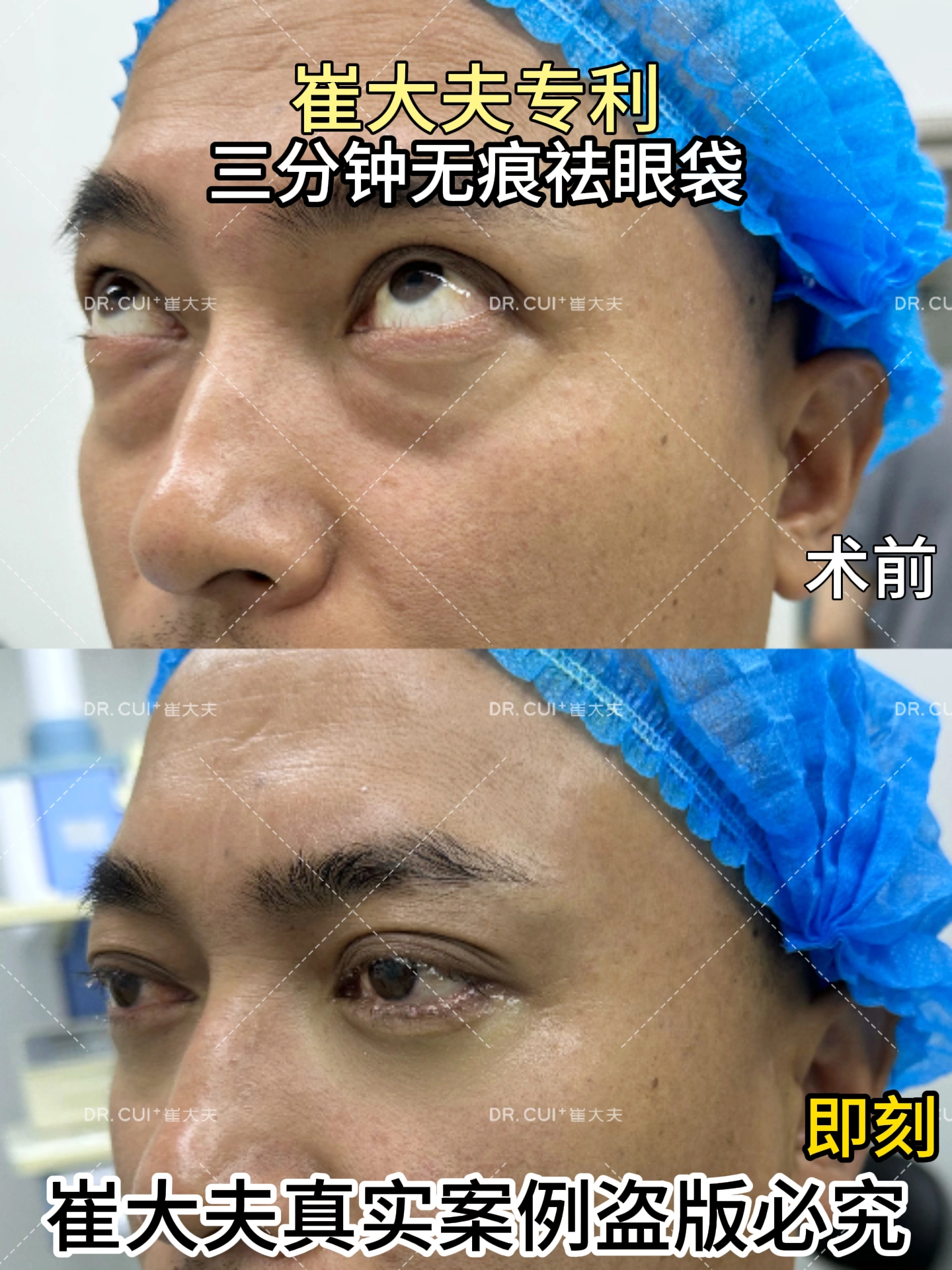 对比 (64)