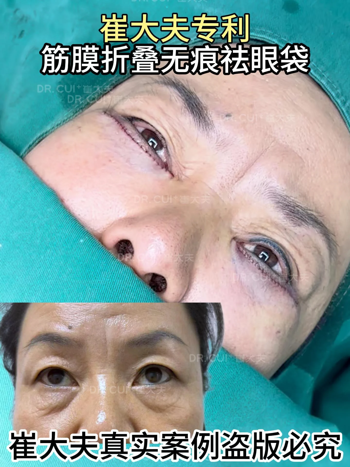 对比 (66)