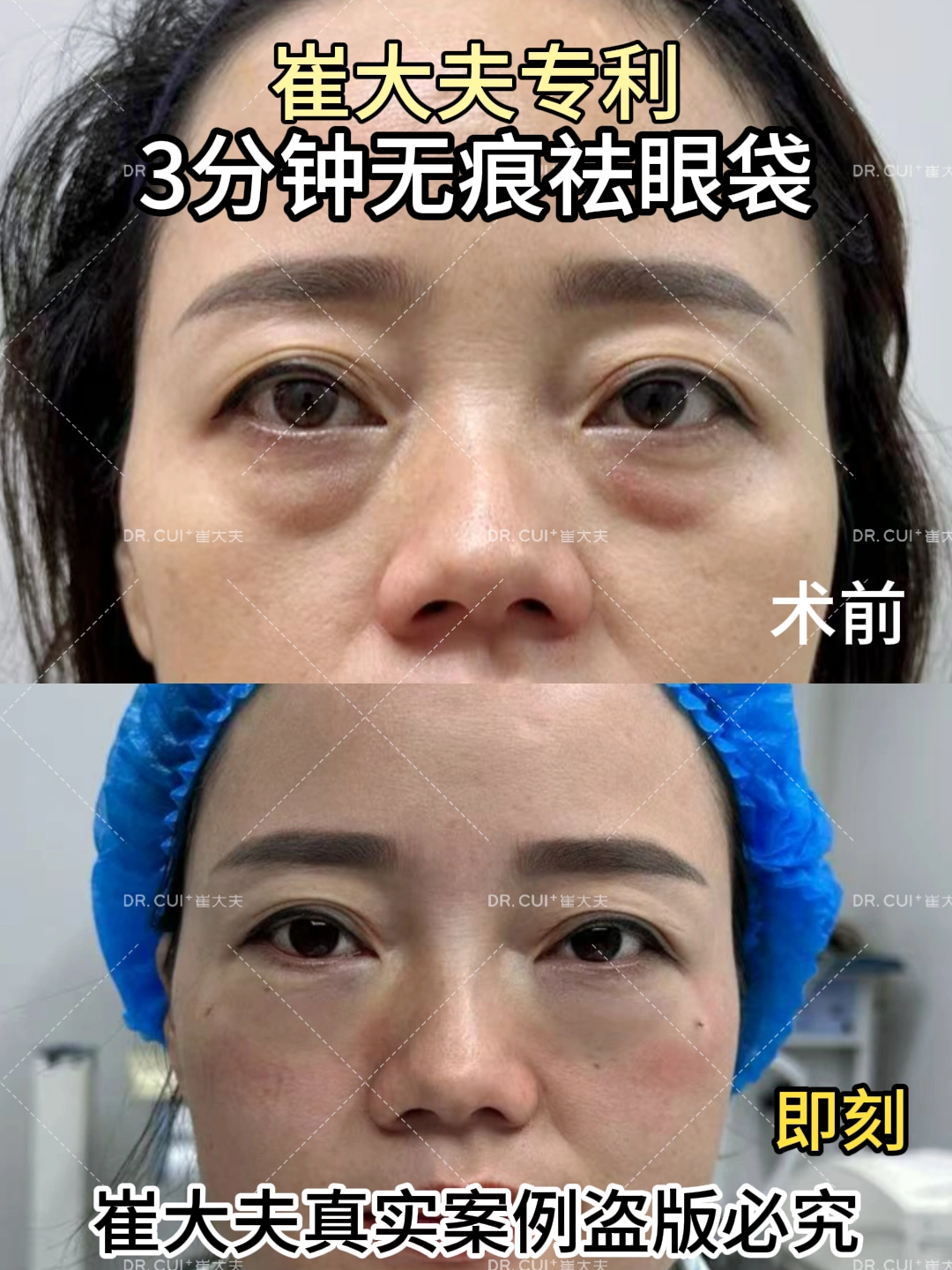 对比 (68)
