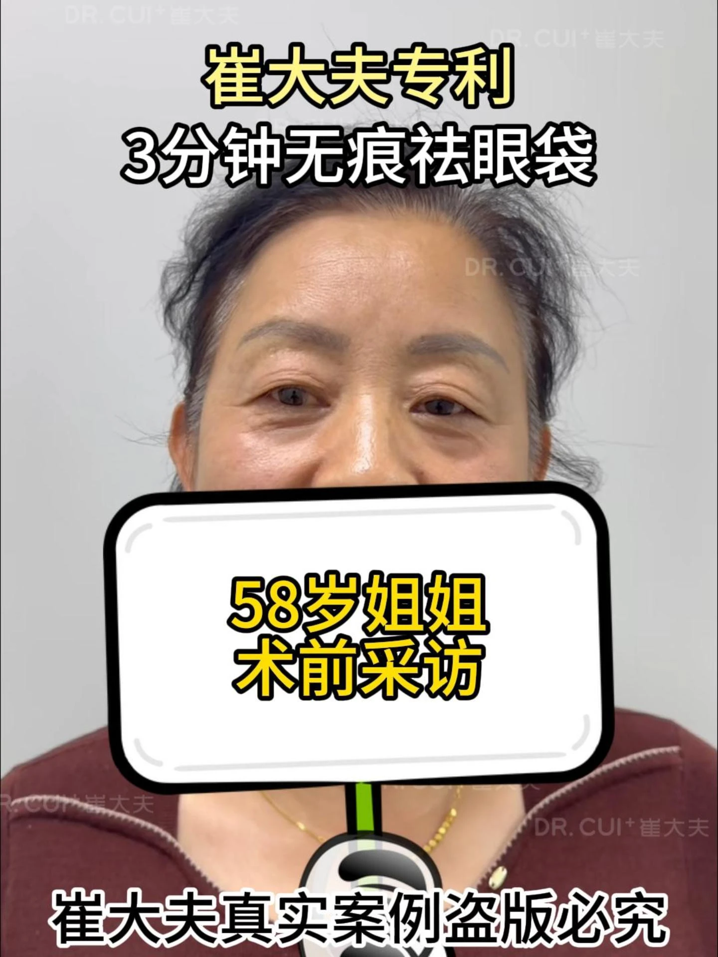 对比 (67)