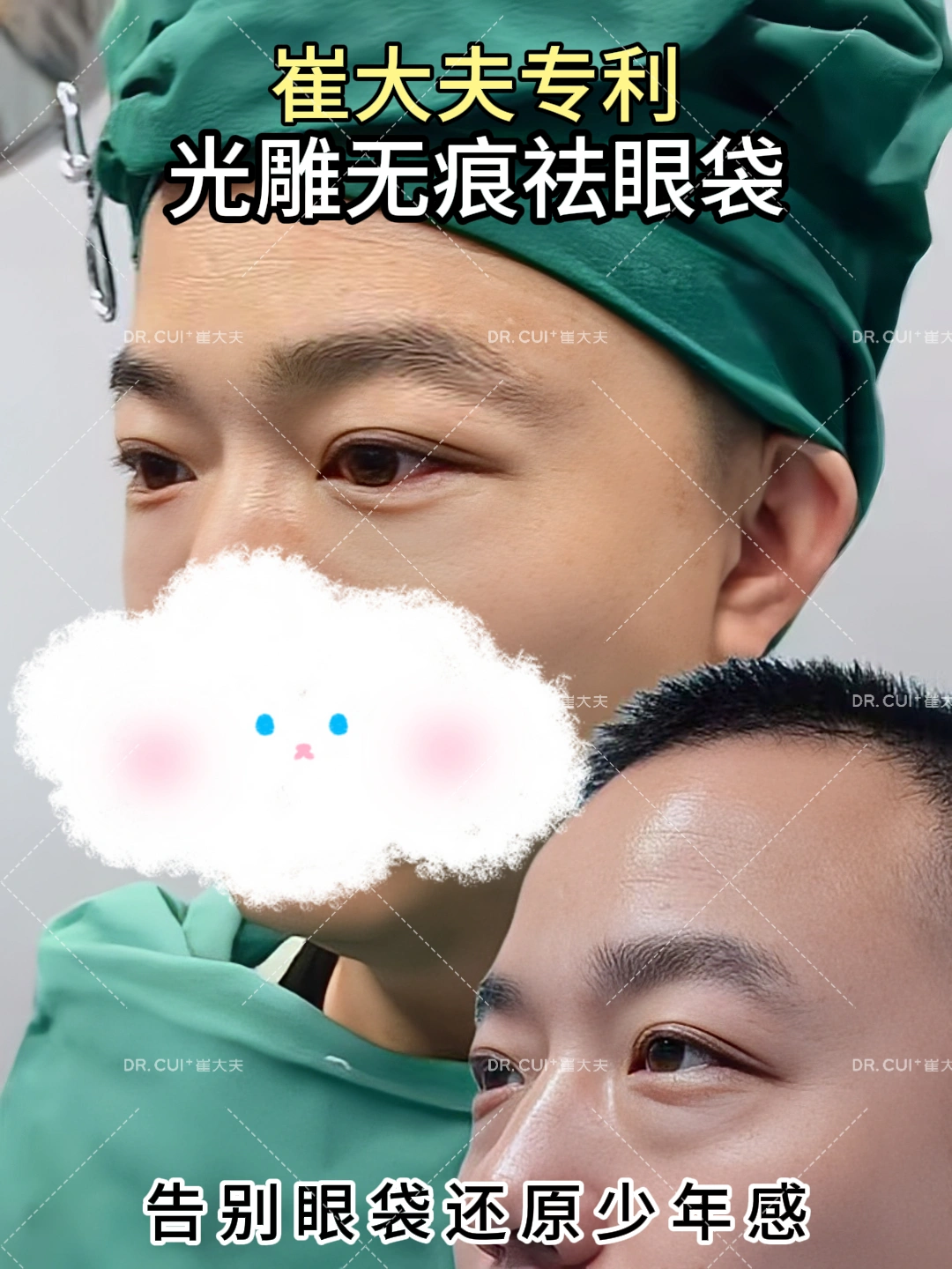 对比 (70)