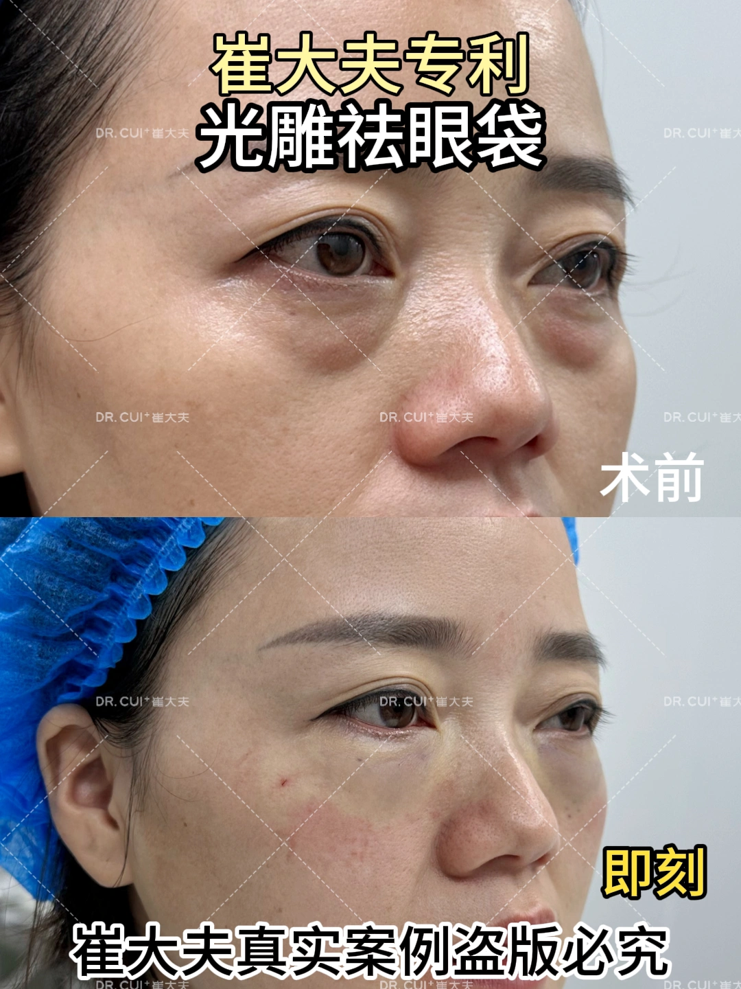 对比 (69)