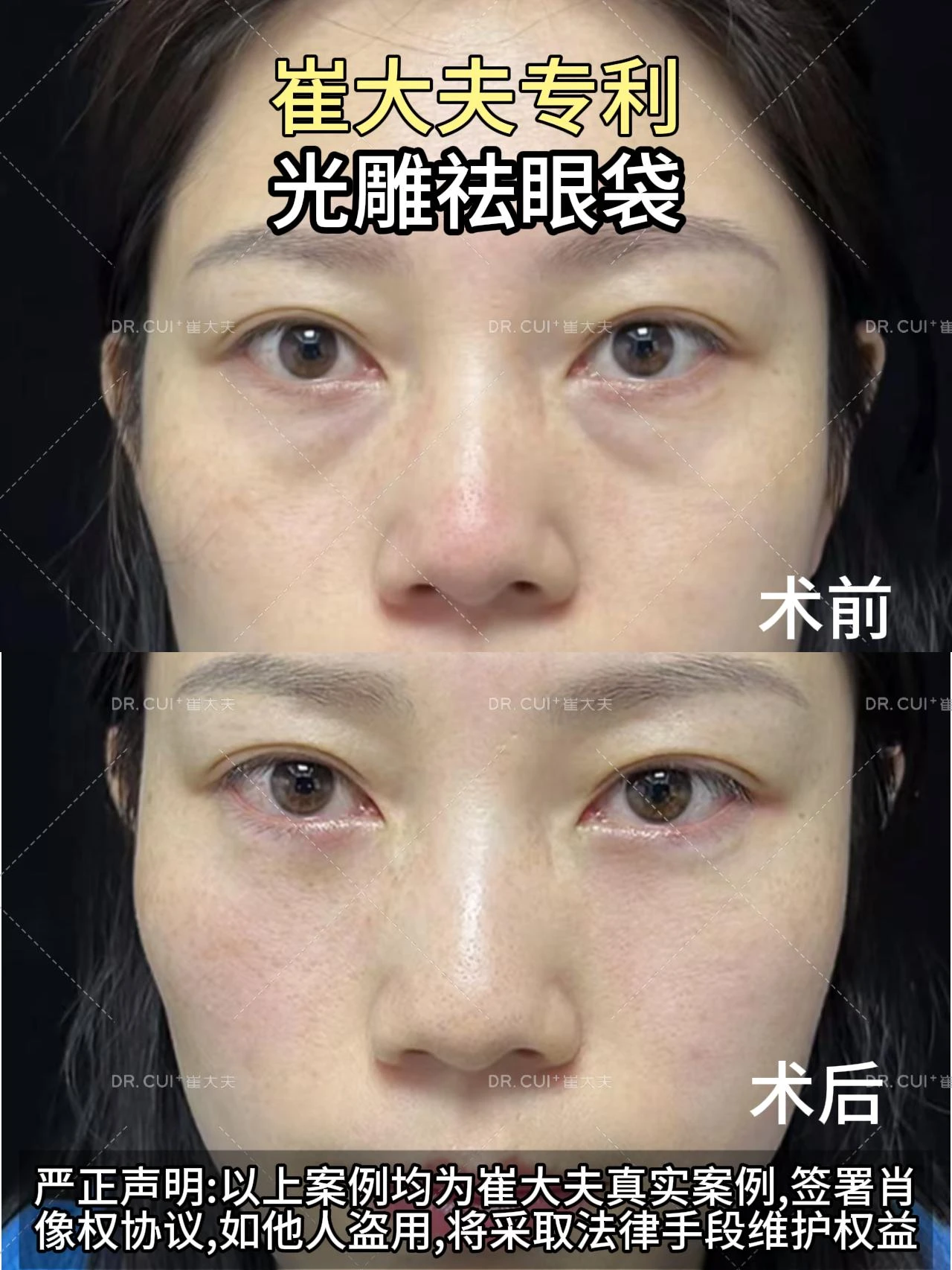 对比 (71)