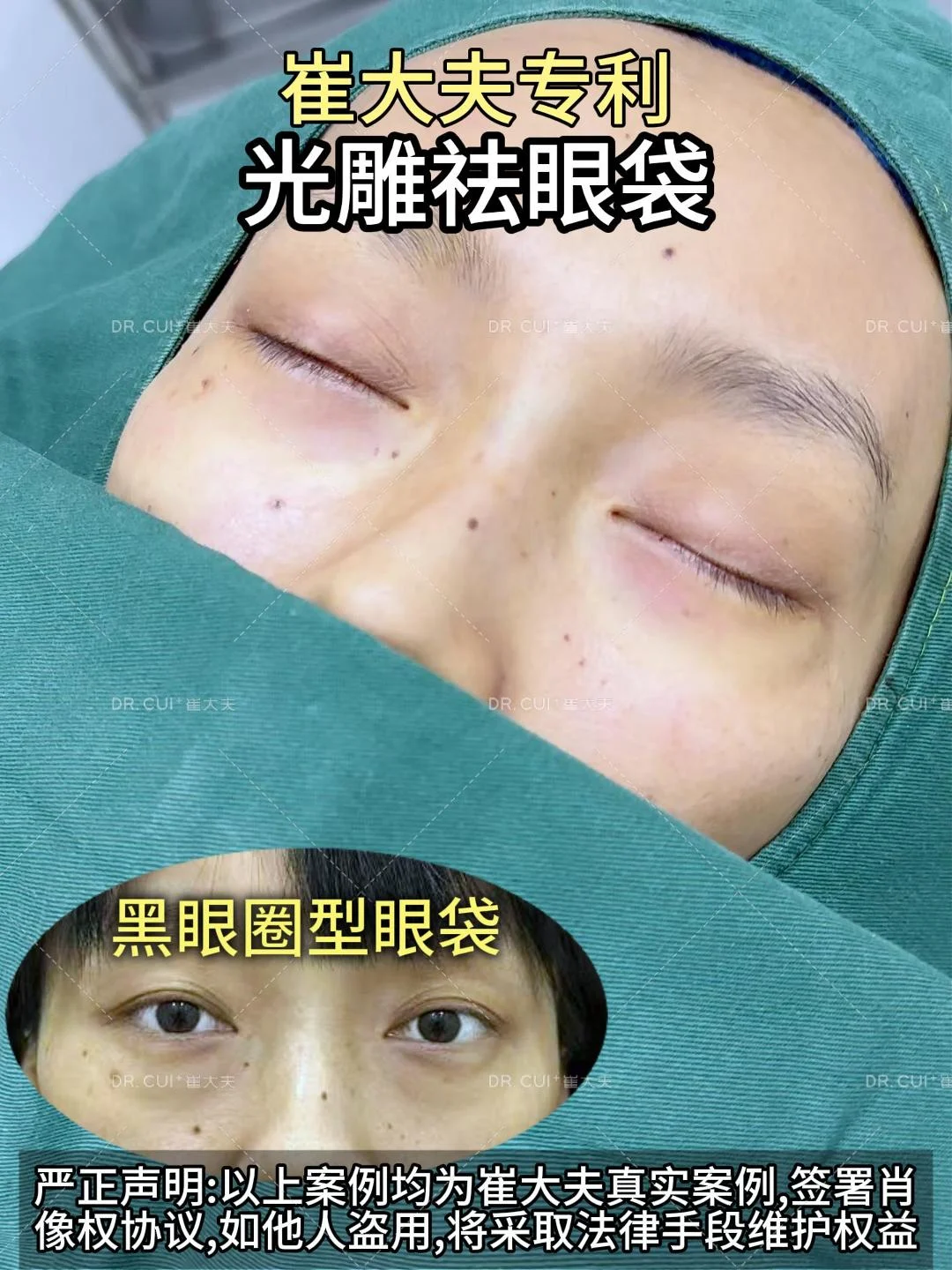 对比 (72)