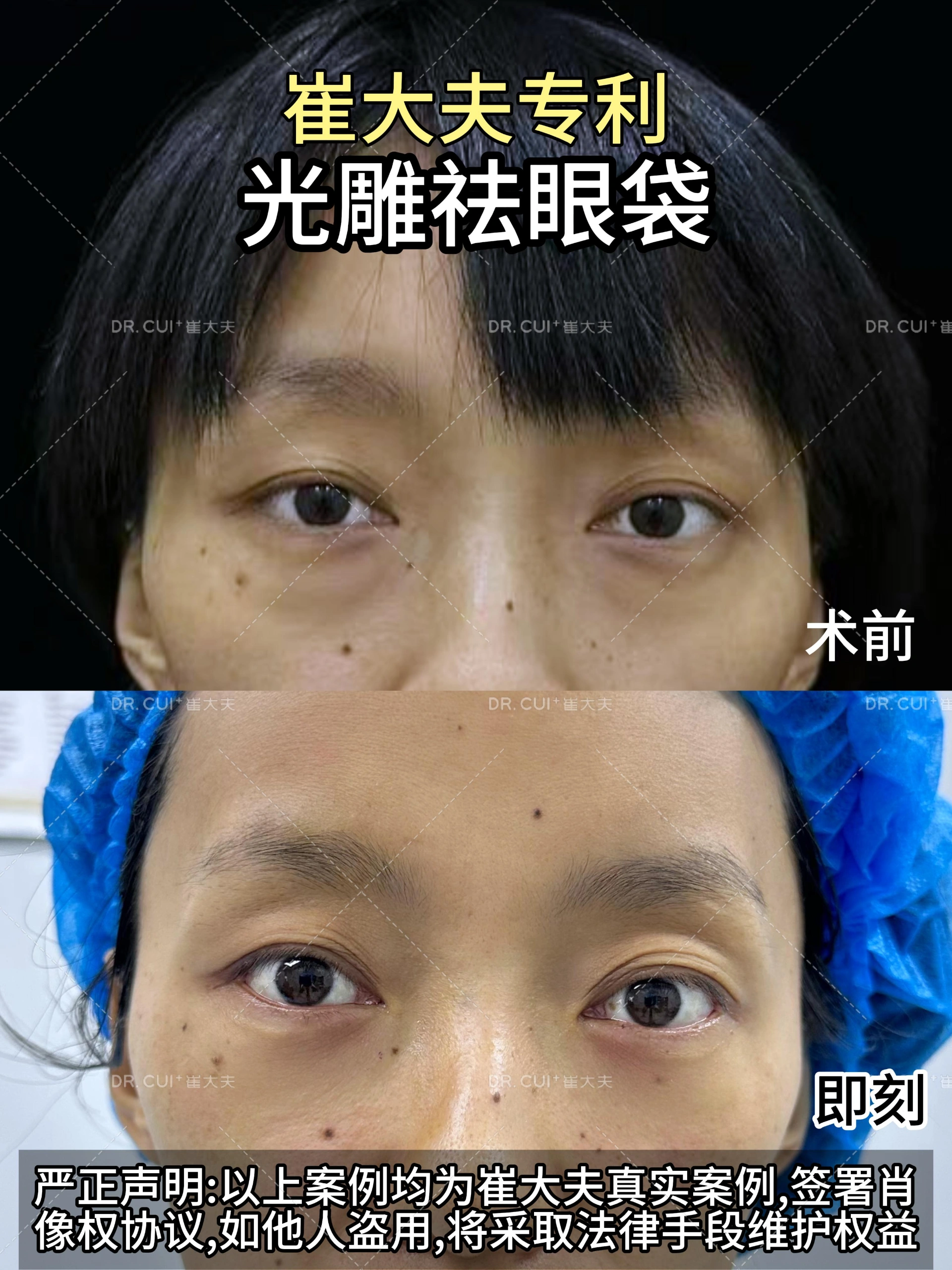 对比 (73)