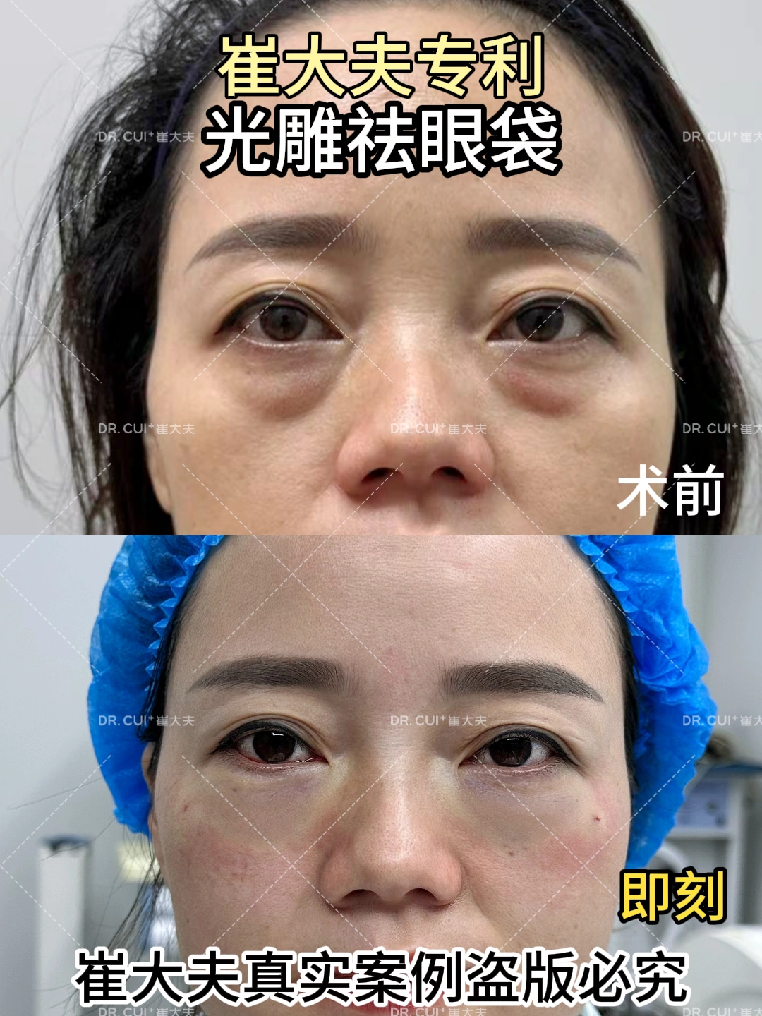 对比 (75)