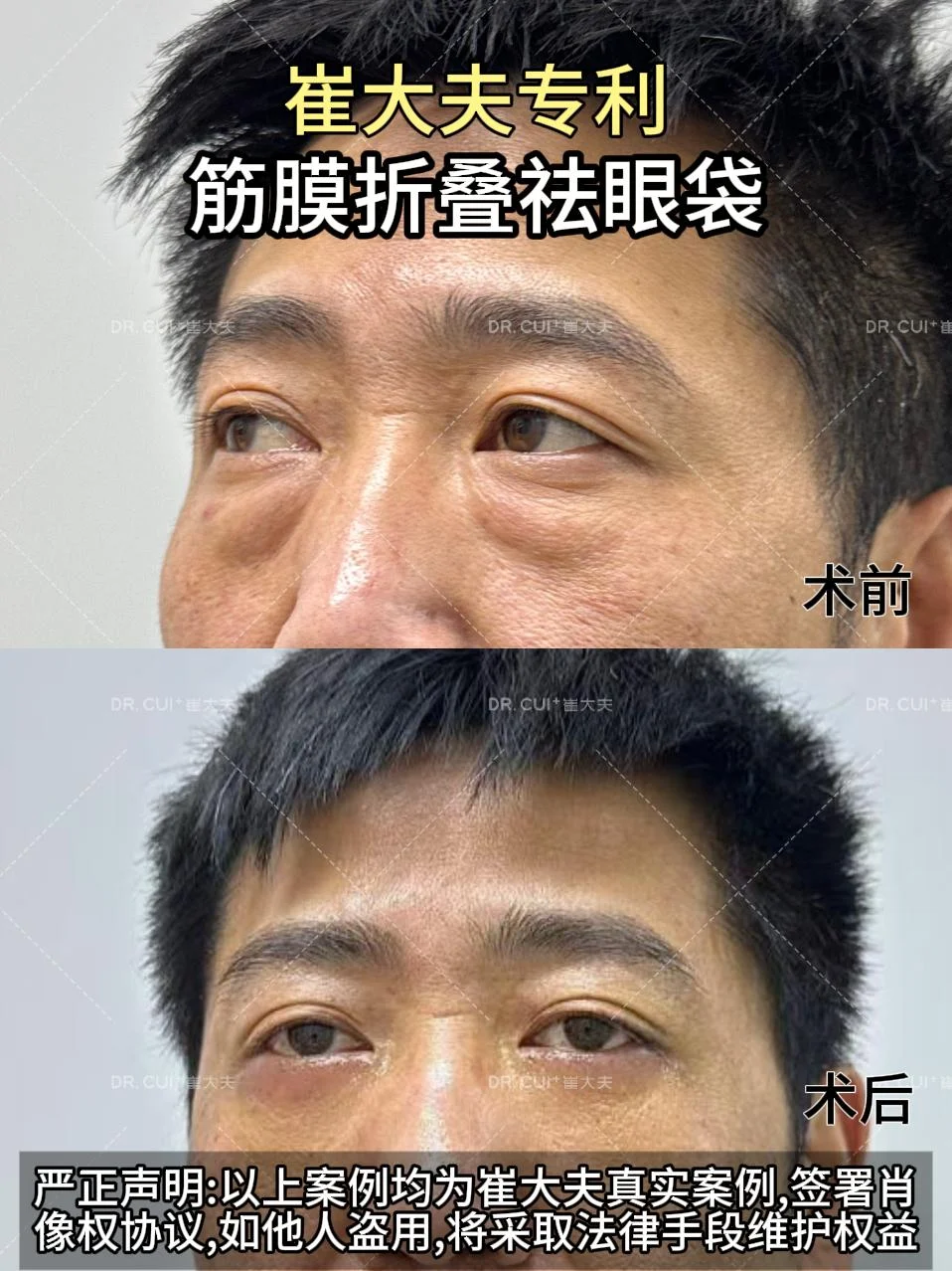 对比(77)