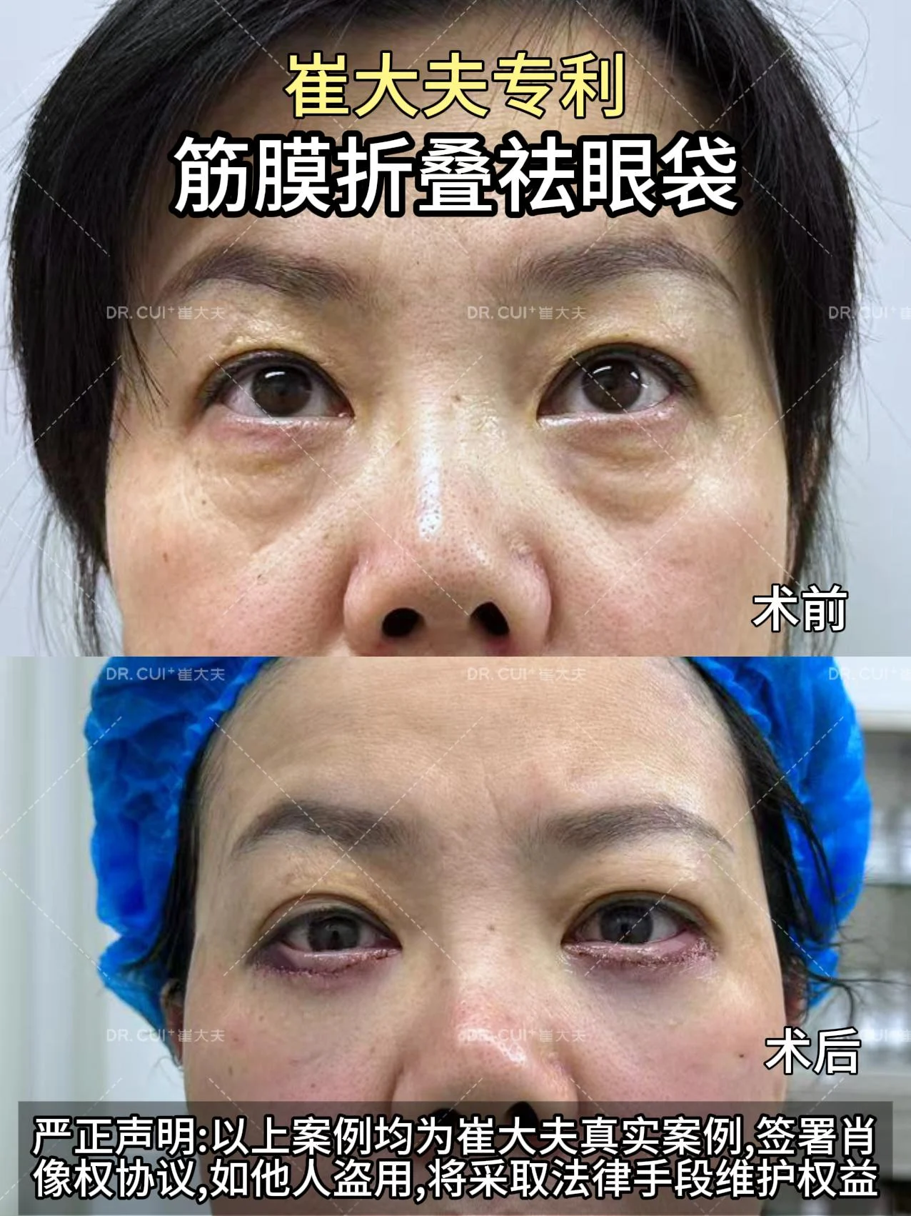 对比(76)