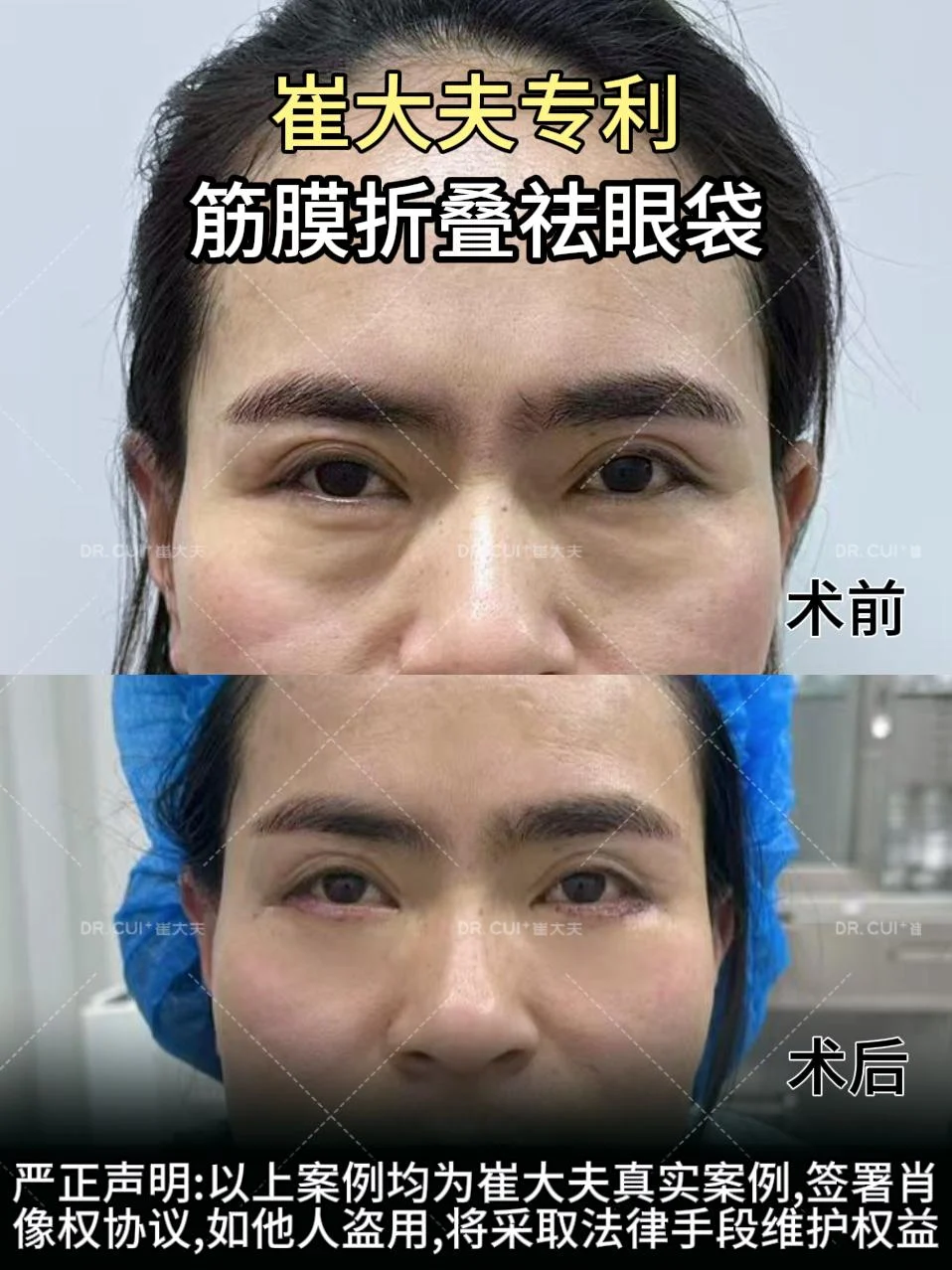 对比(79)