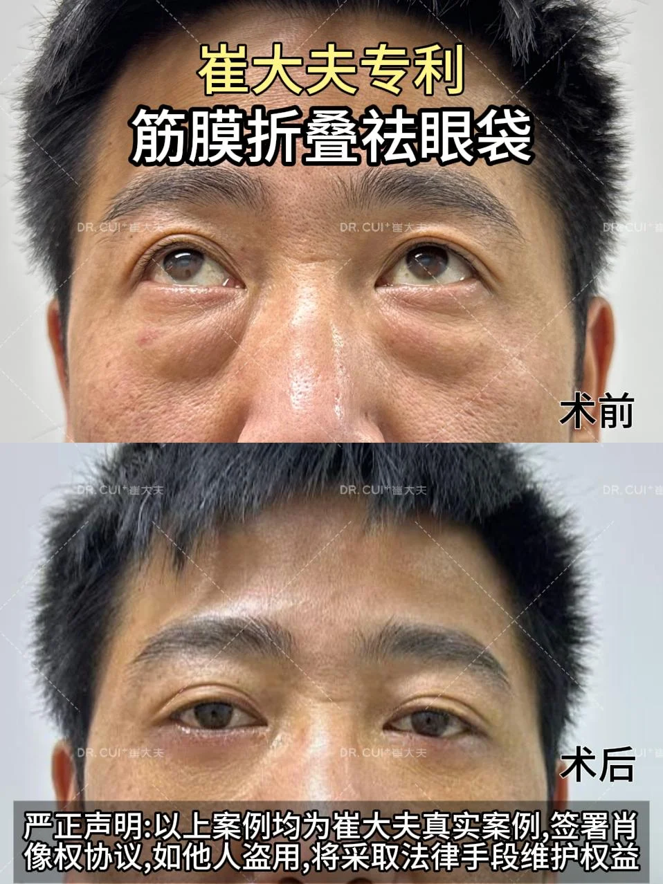 对比(78)