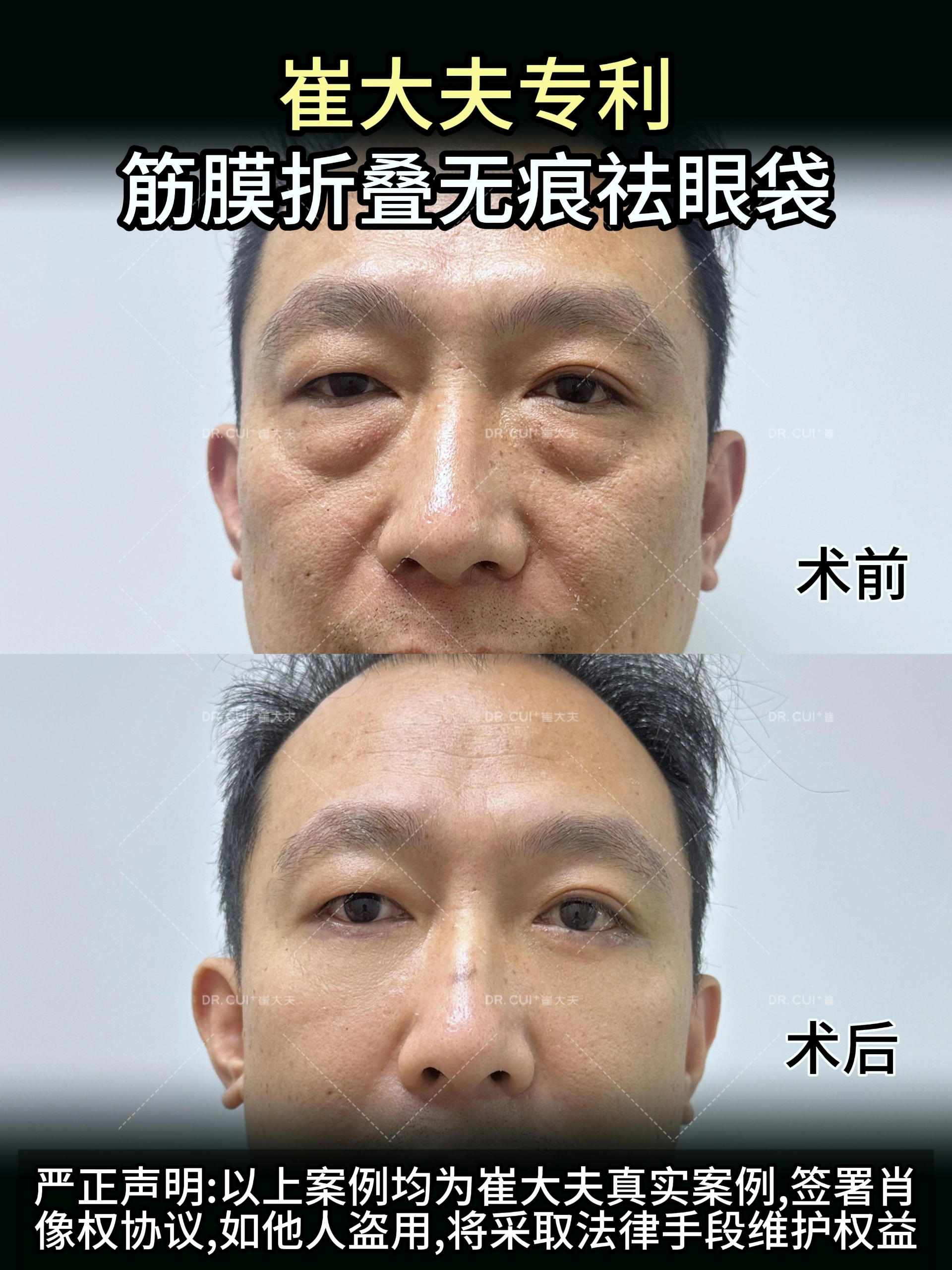 对比(80)