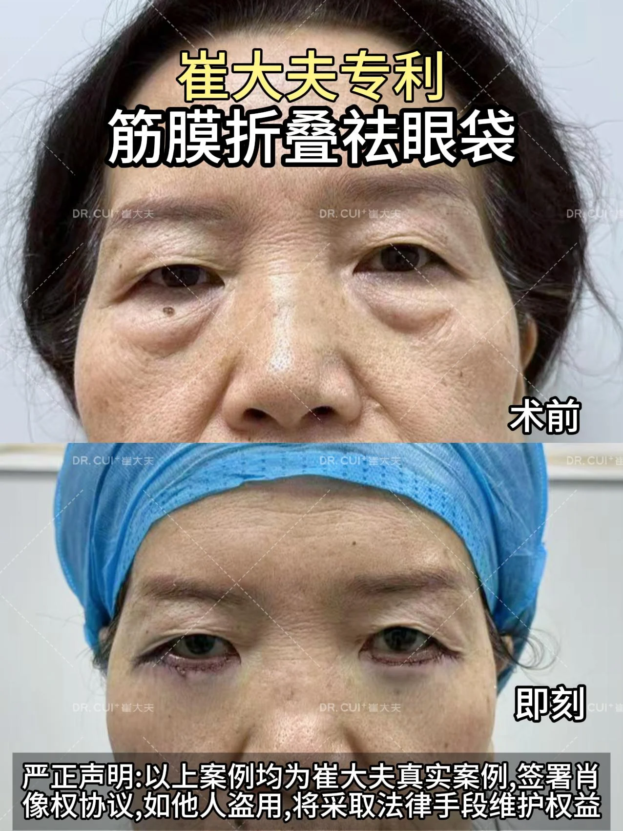 对比(81)