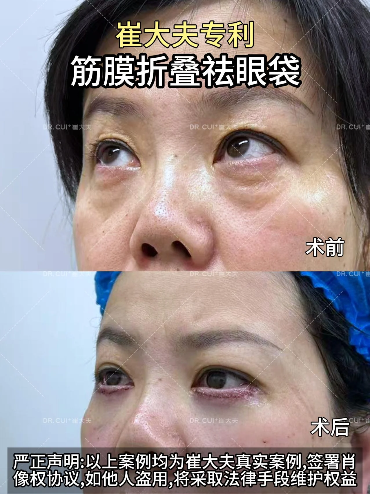 对比(82)