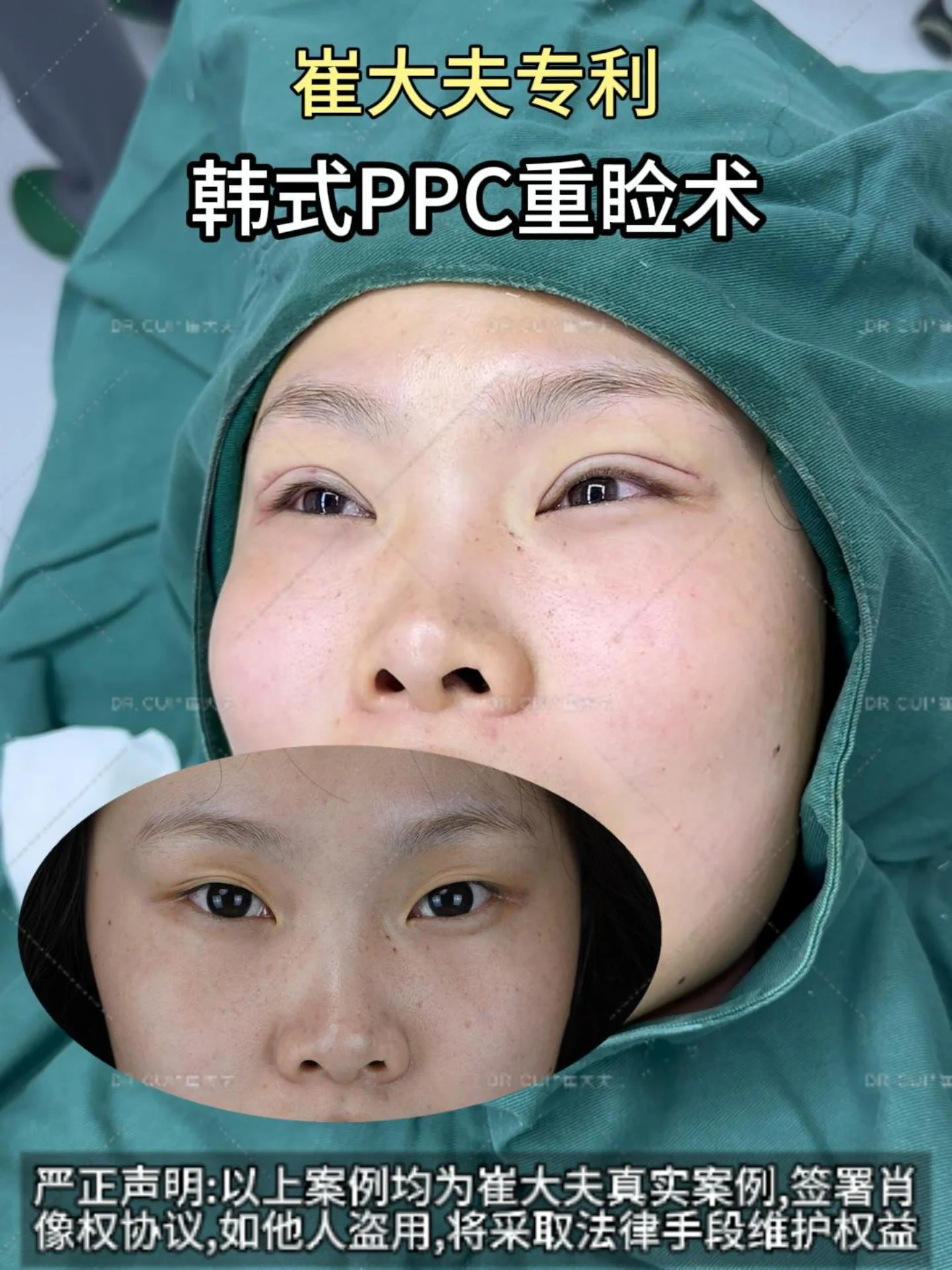 对比 (4)