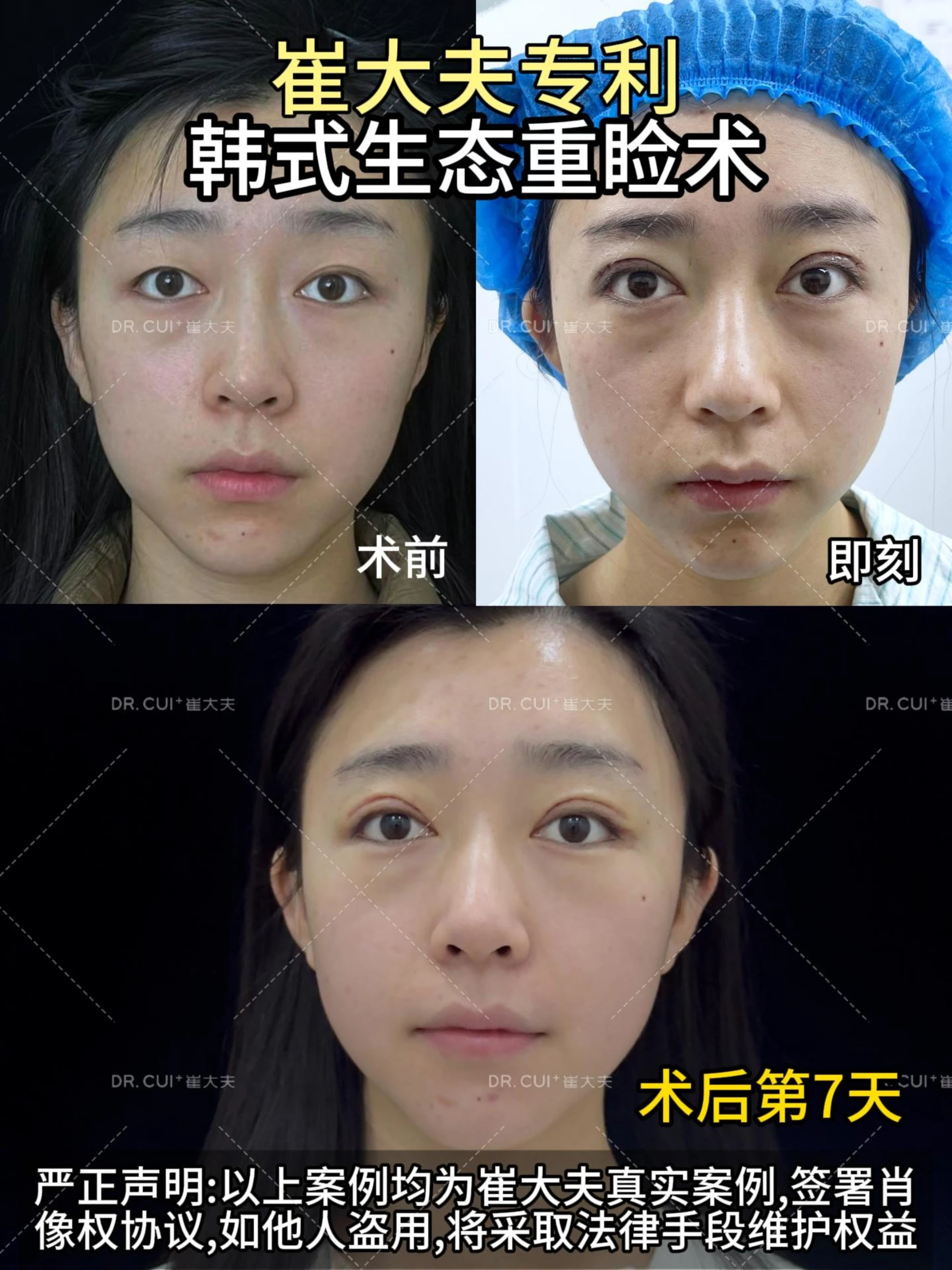 对比 (8)