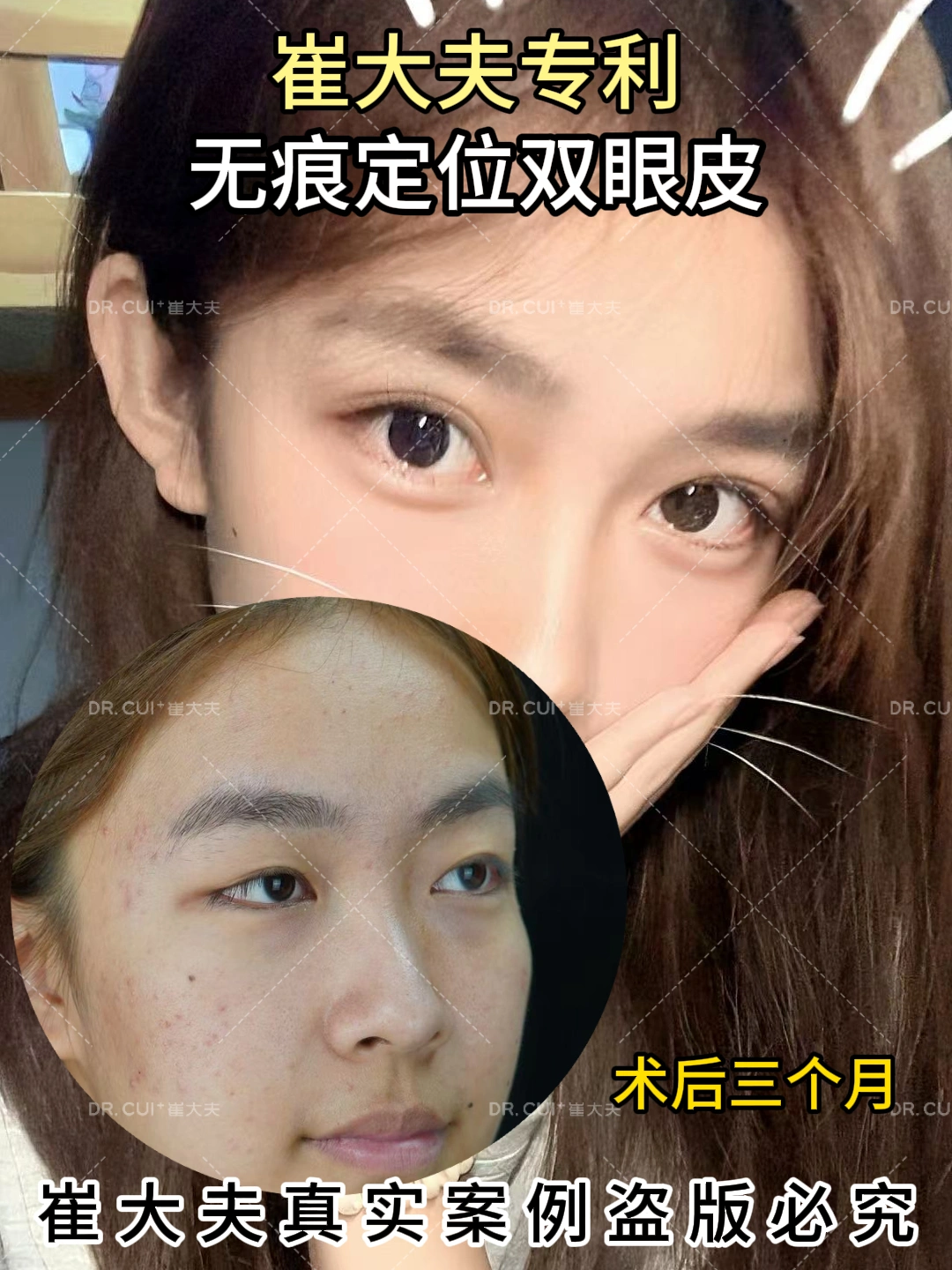 对比 (15)