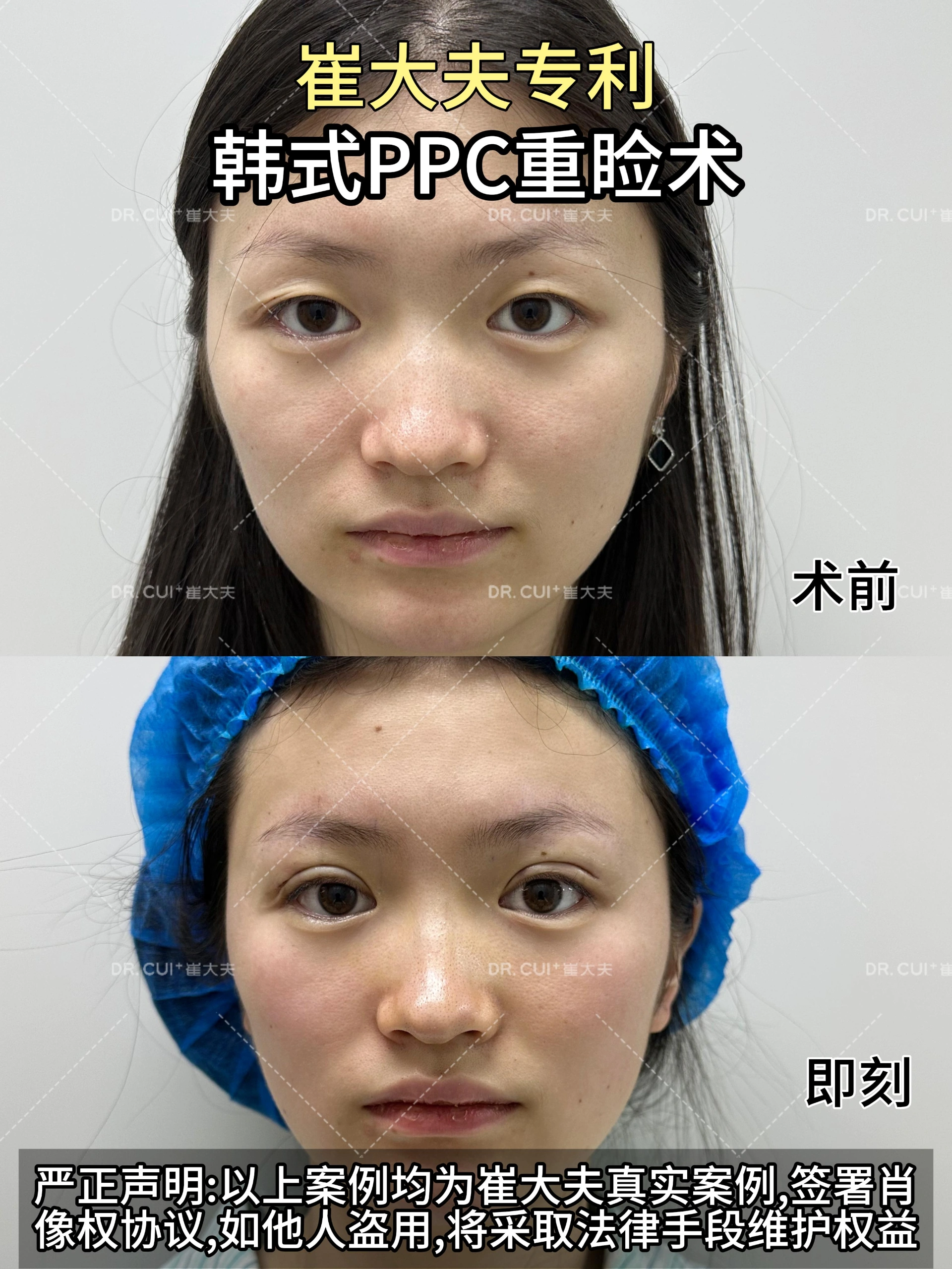 对比 (24)