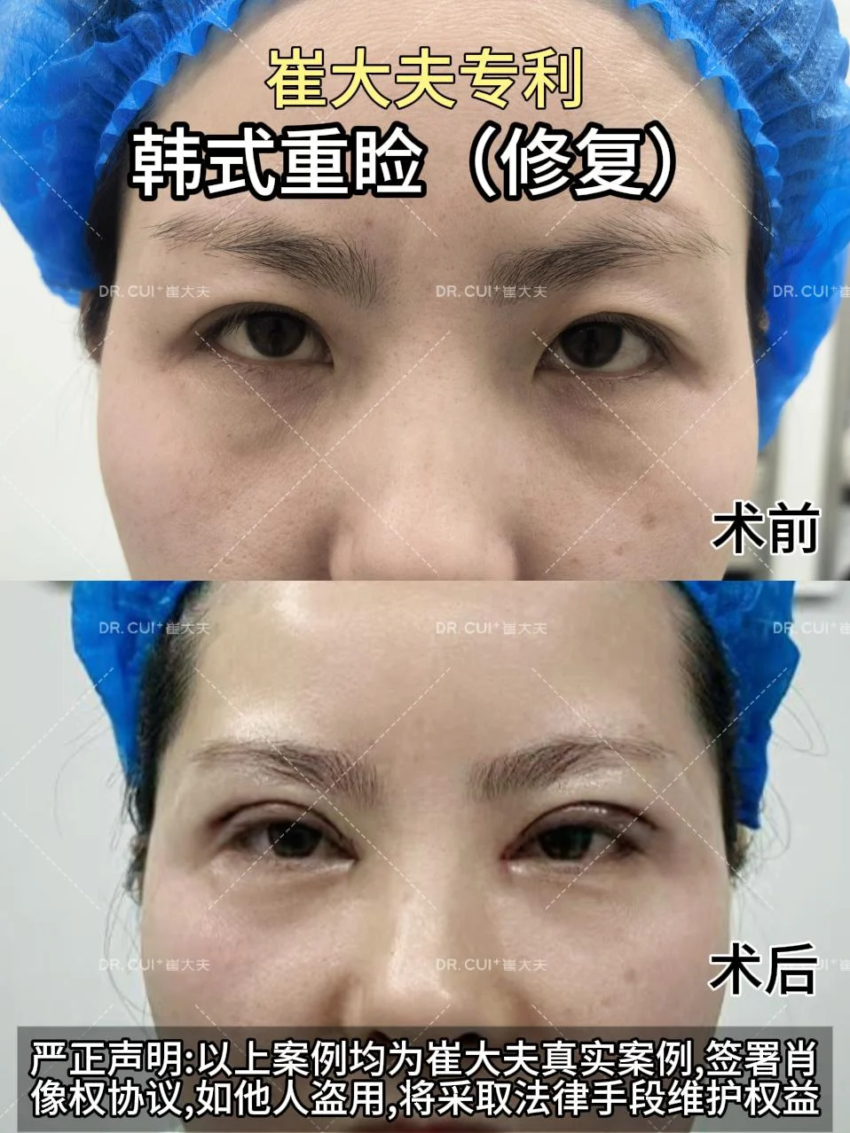 对比 (25)