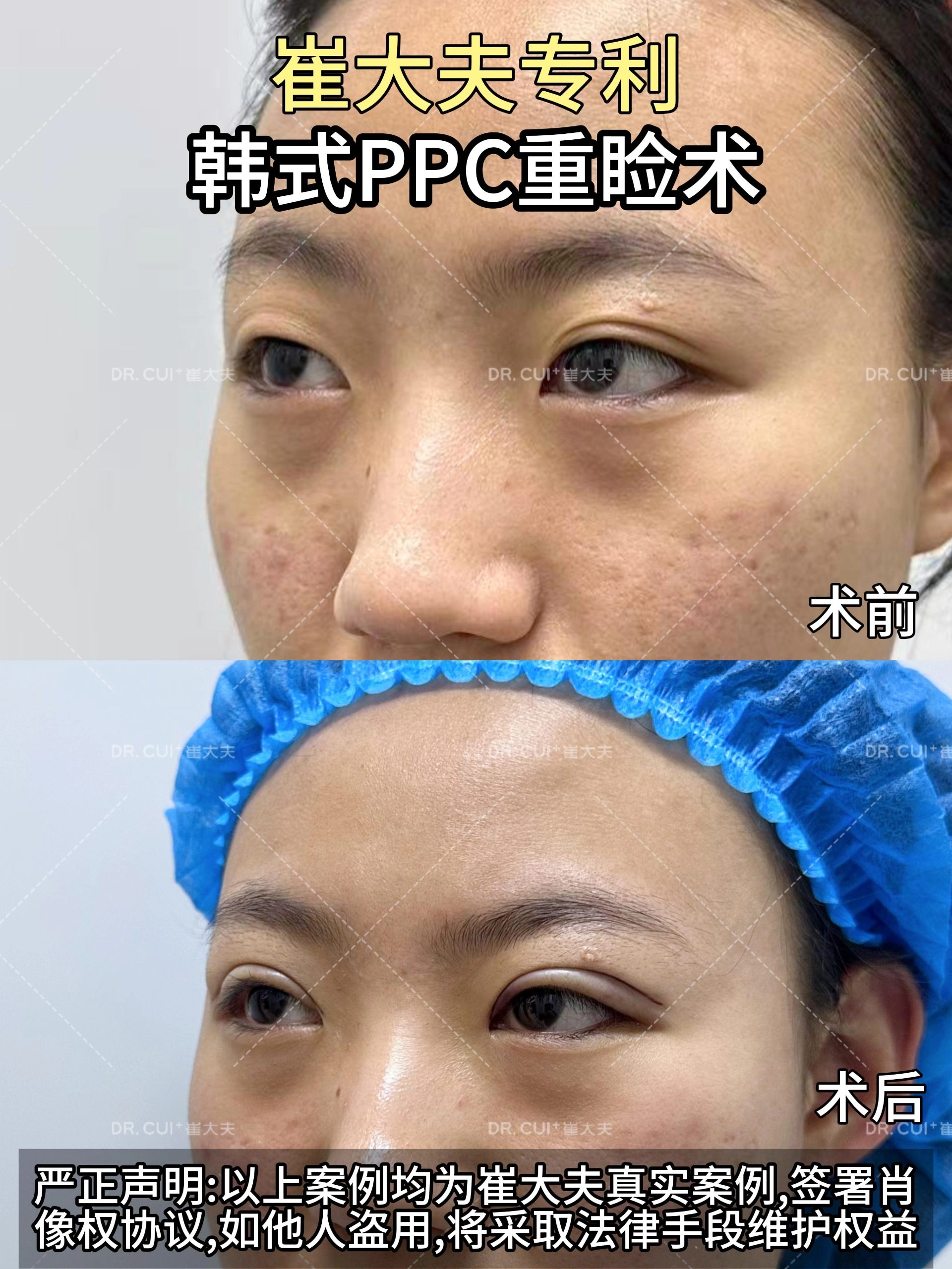 对比 (26)