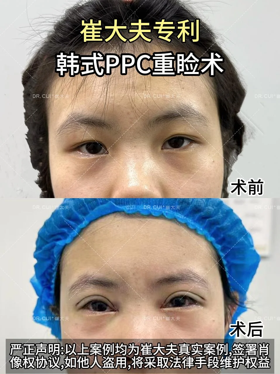对比 (29)