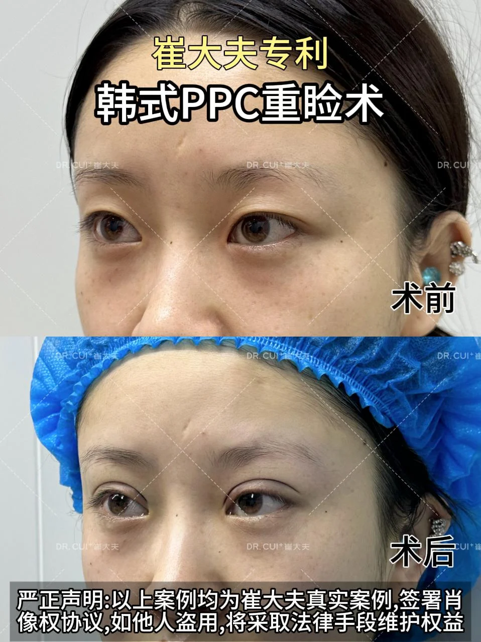 对比 (32)