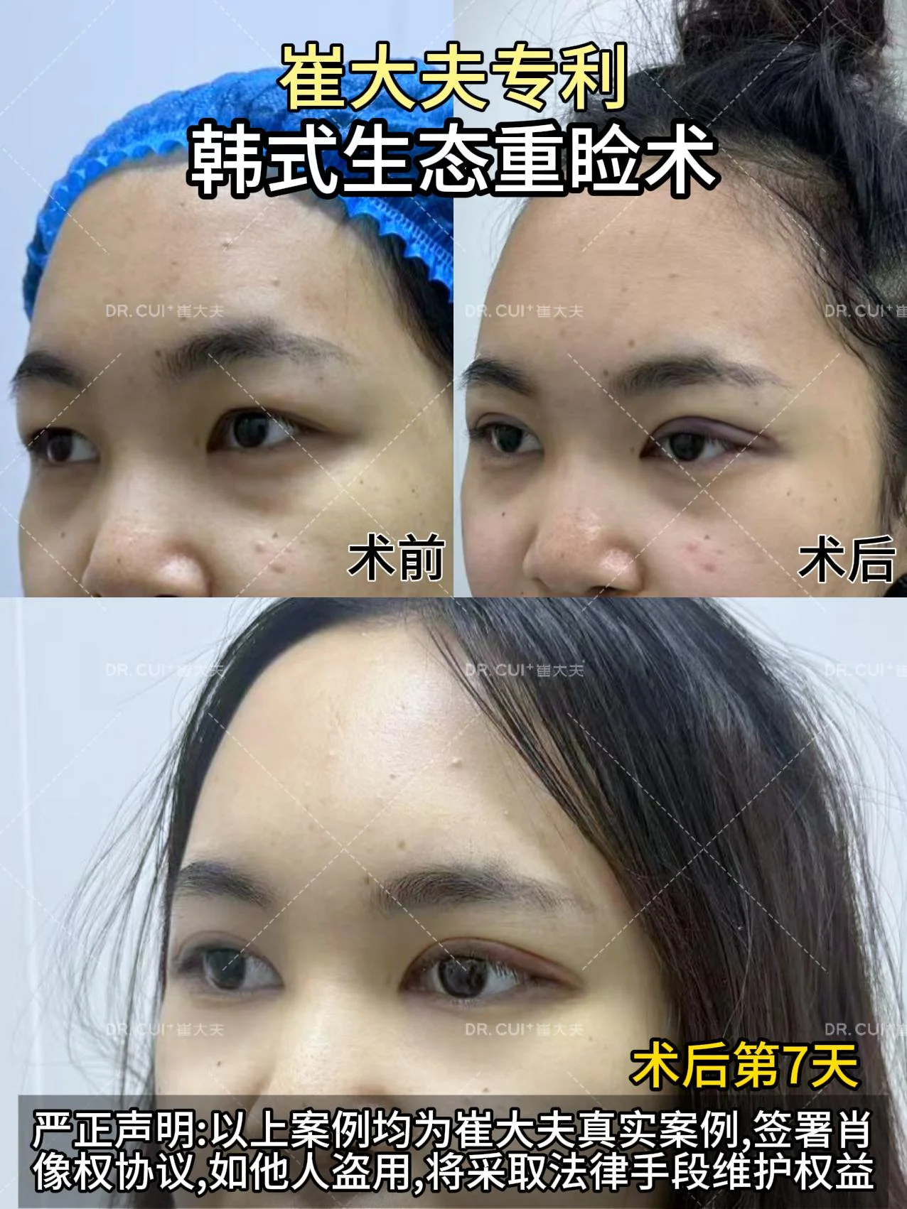 对比 (34)