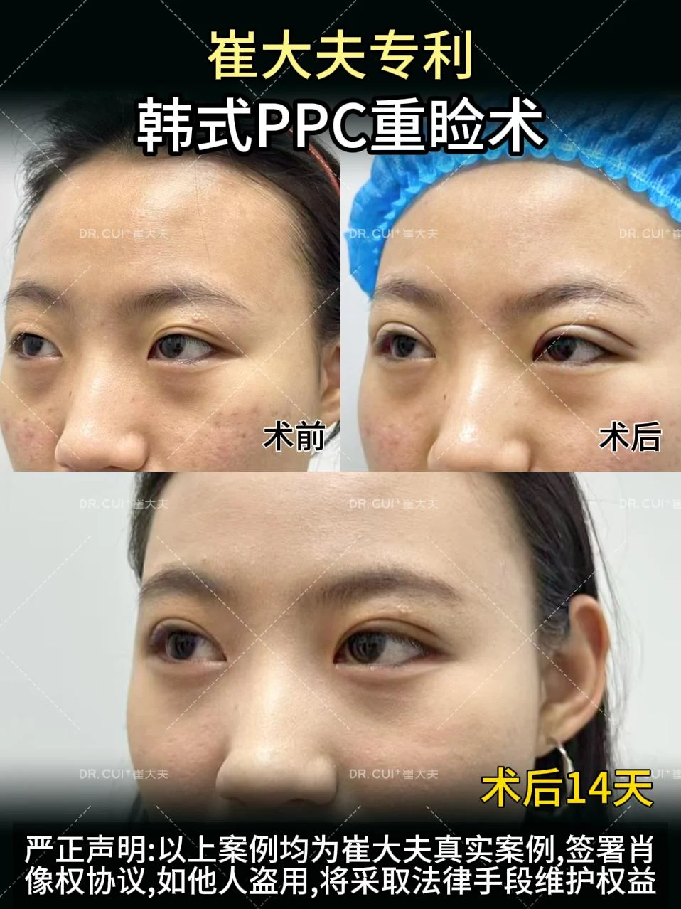 对比 (39)